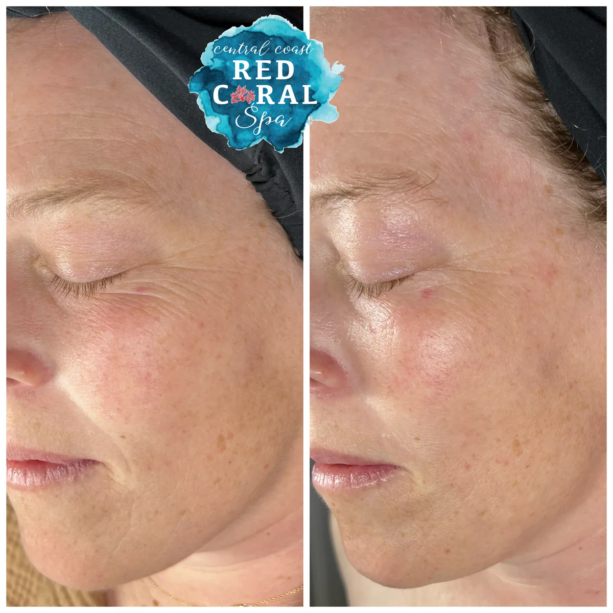 Before and after treatment results