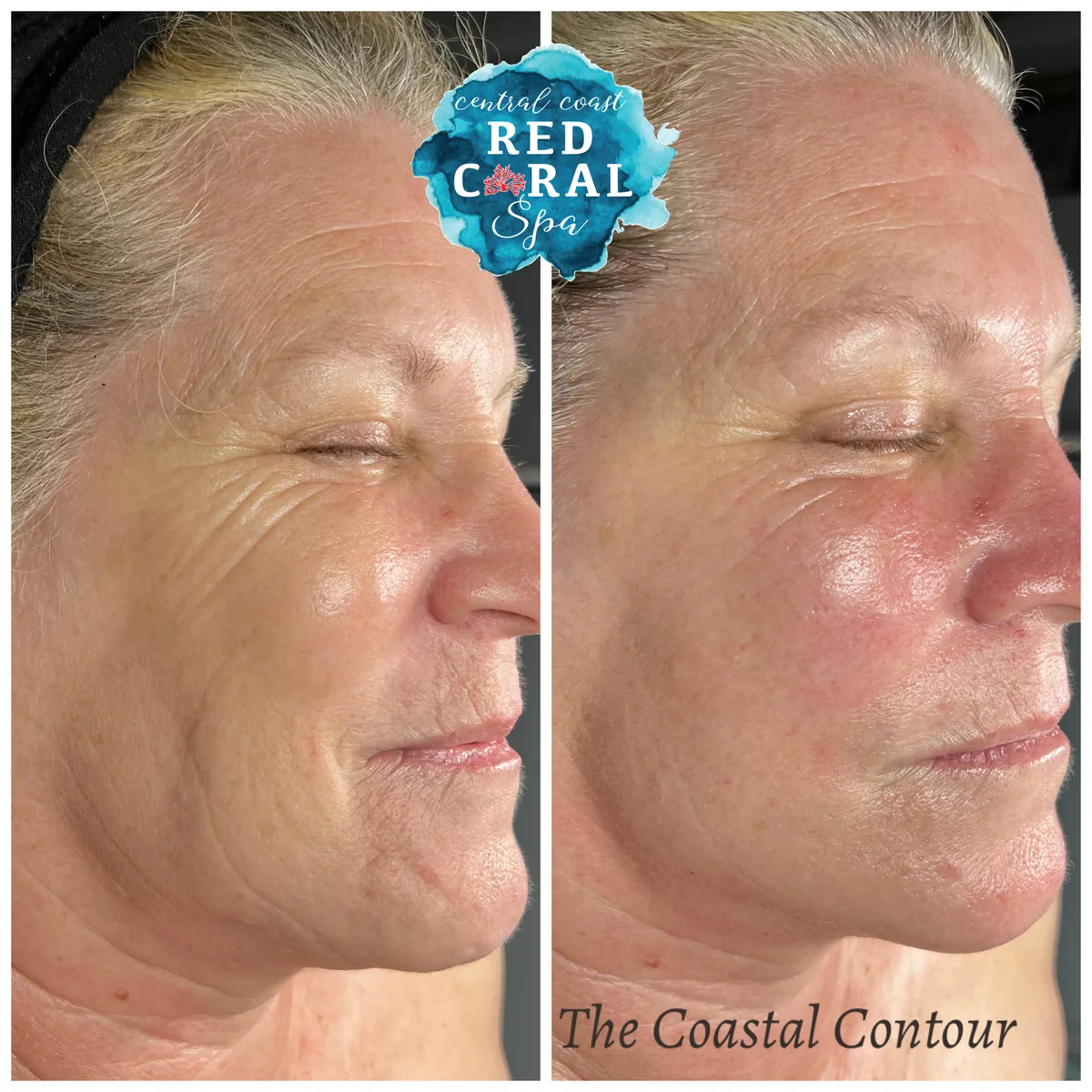 Before and after treatment results