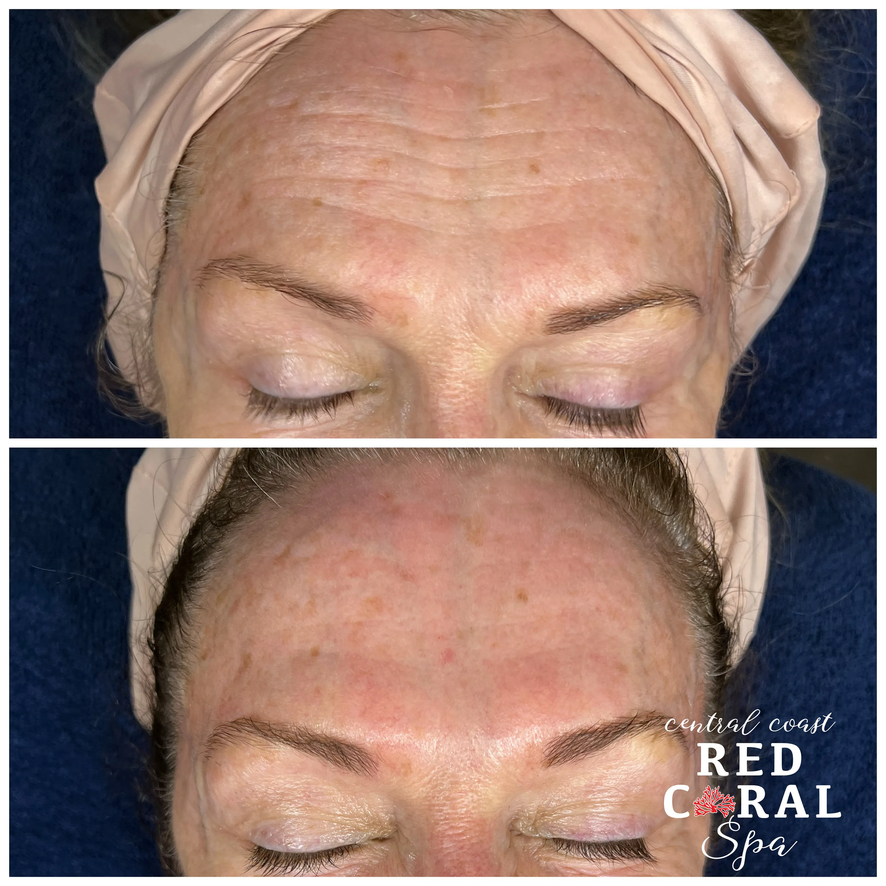 Before and after treatment results