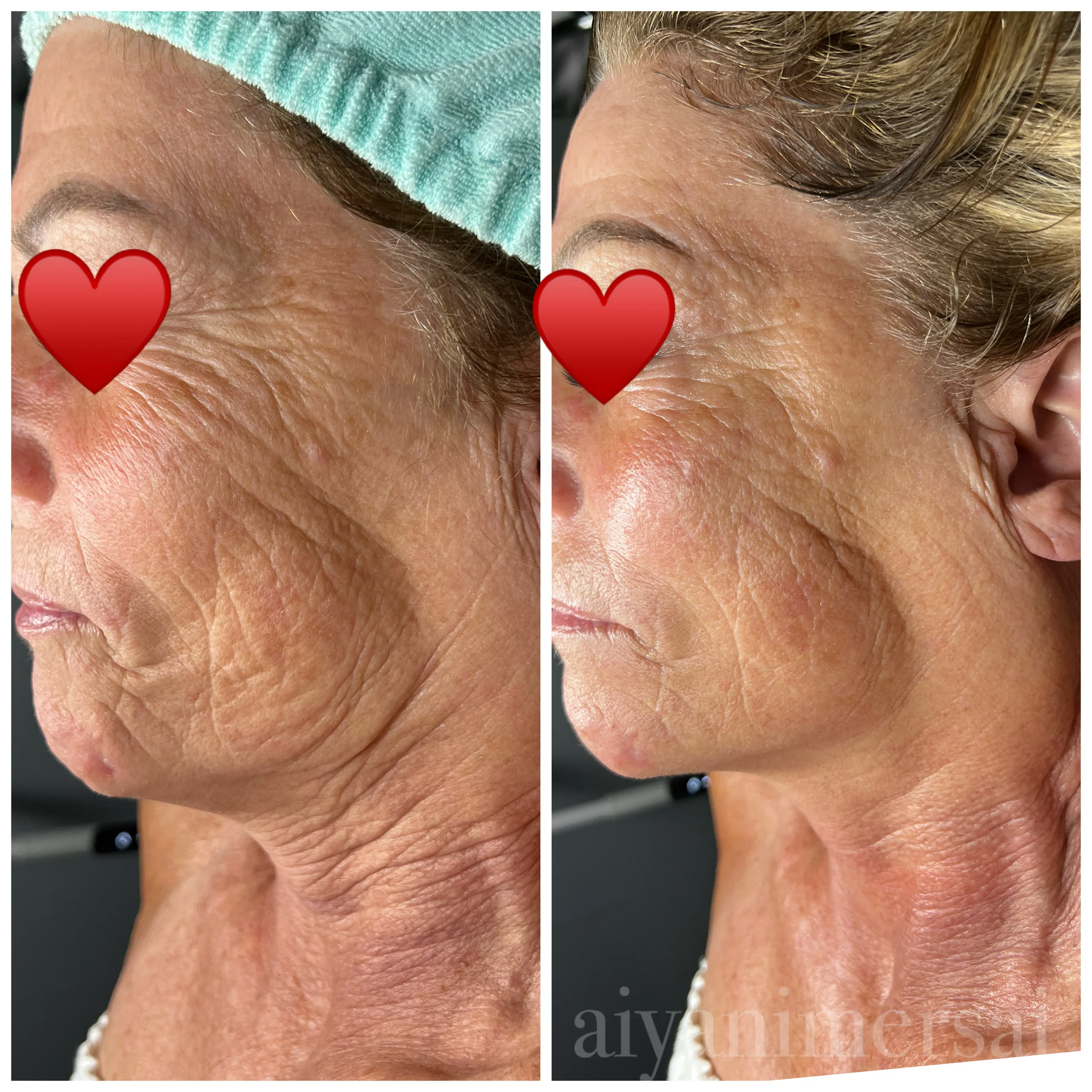 Before and after treatment results