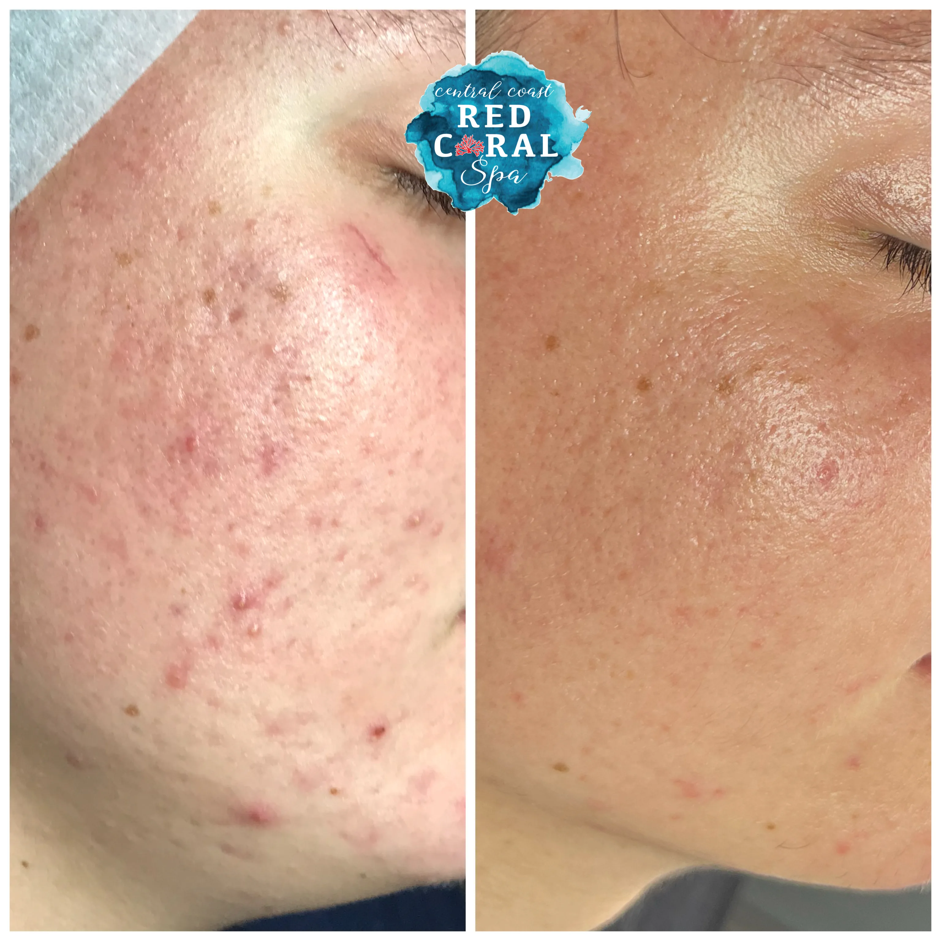 Before and after treatment results