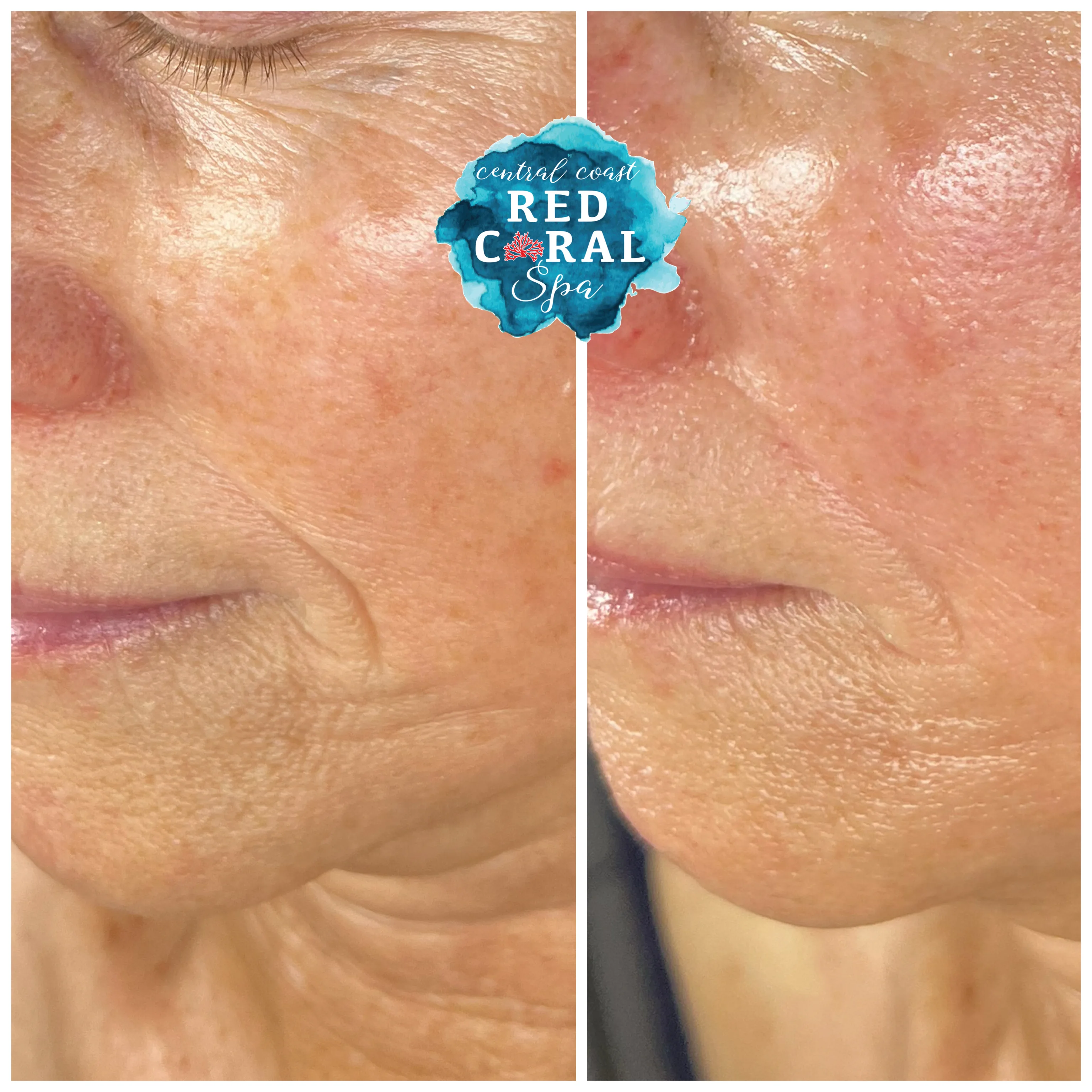 Before and after treatment results