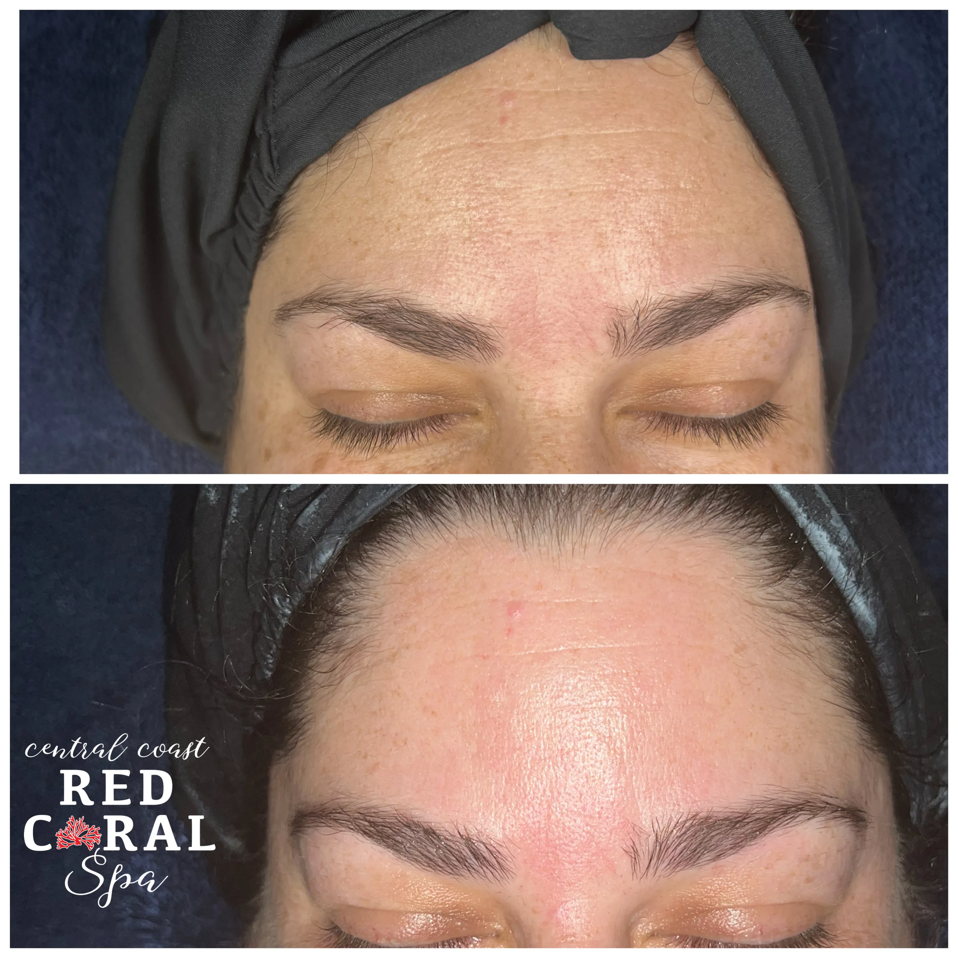 Before and after treatment results