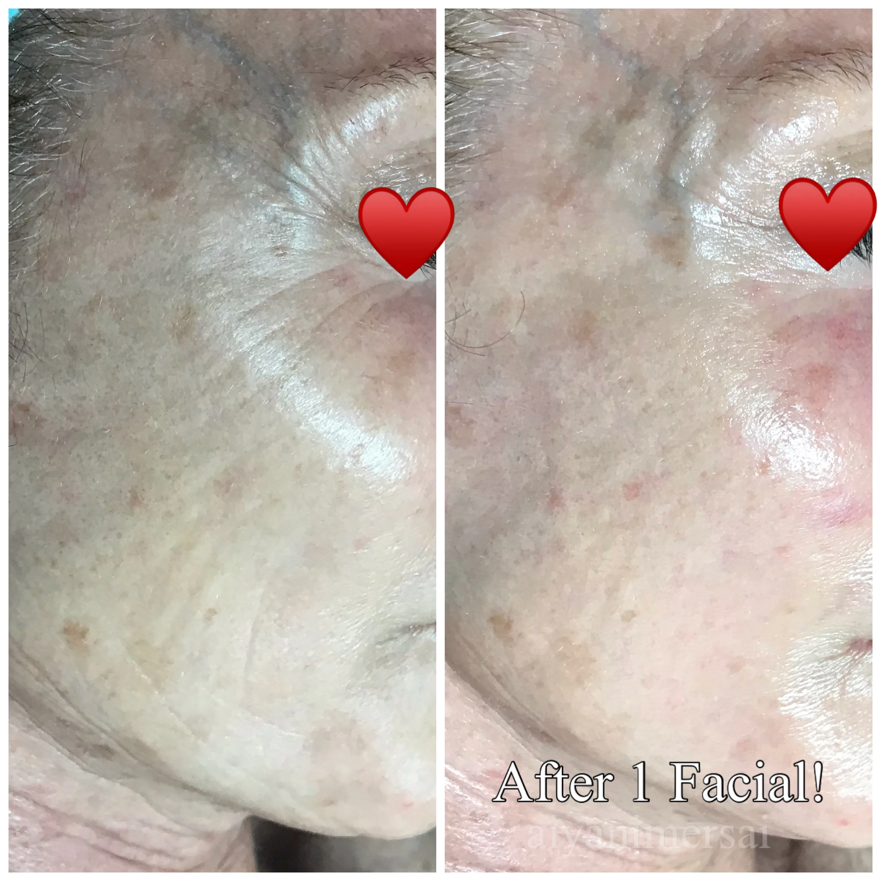 Before and after treatment results