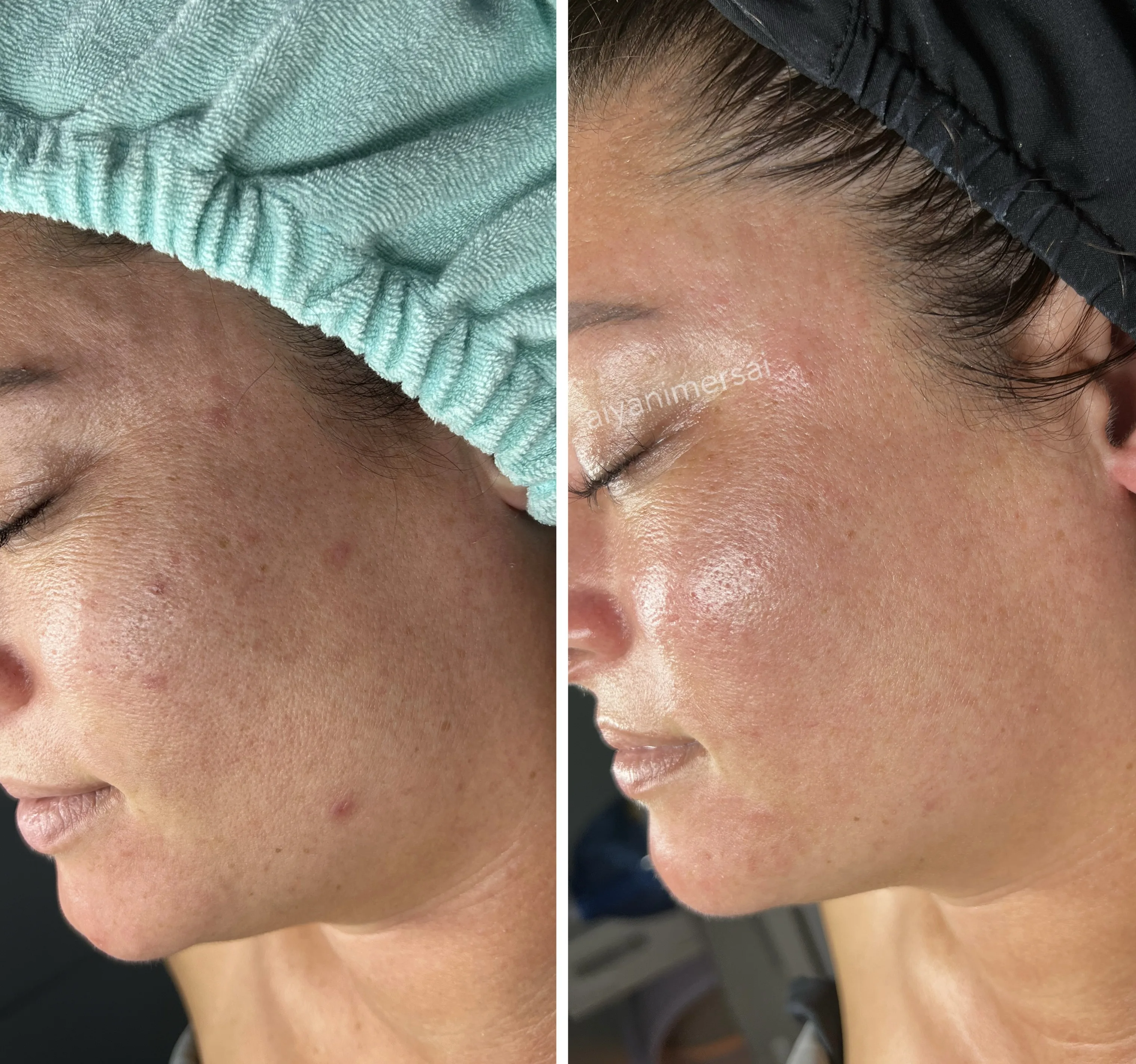 Ashley S. M. — before and after results