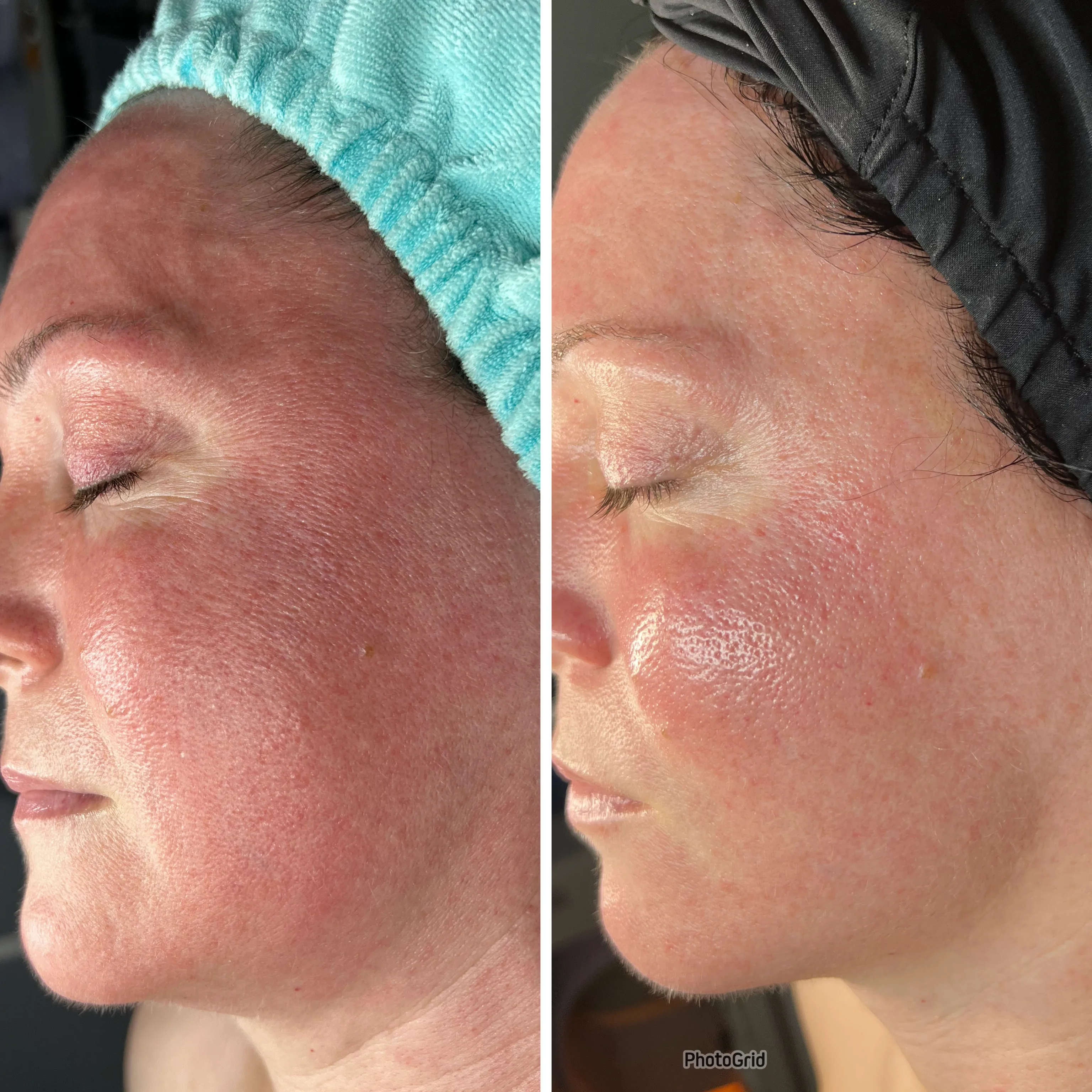 Before and after treatment results