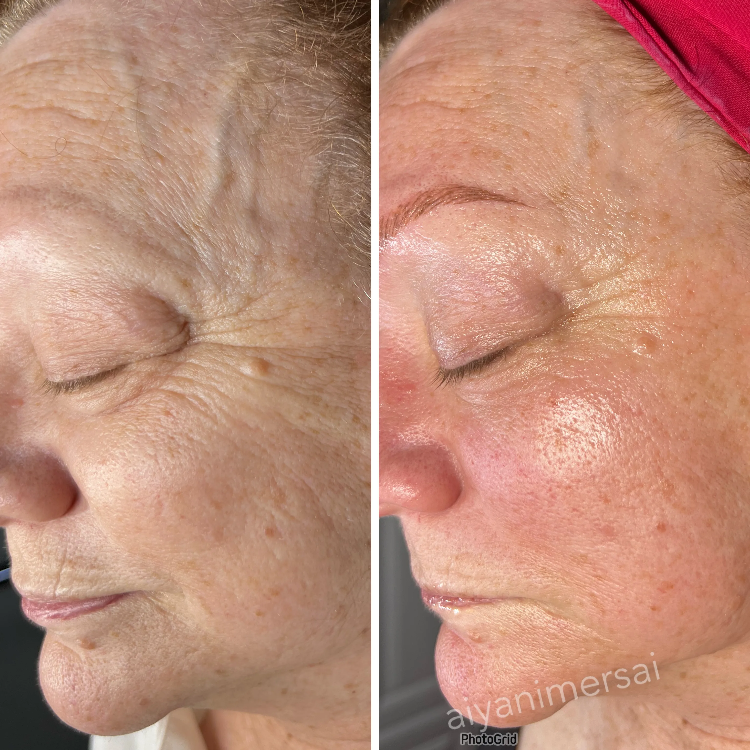 Before and after treatment results