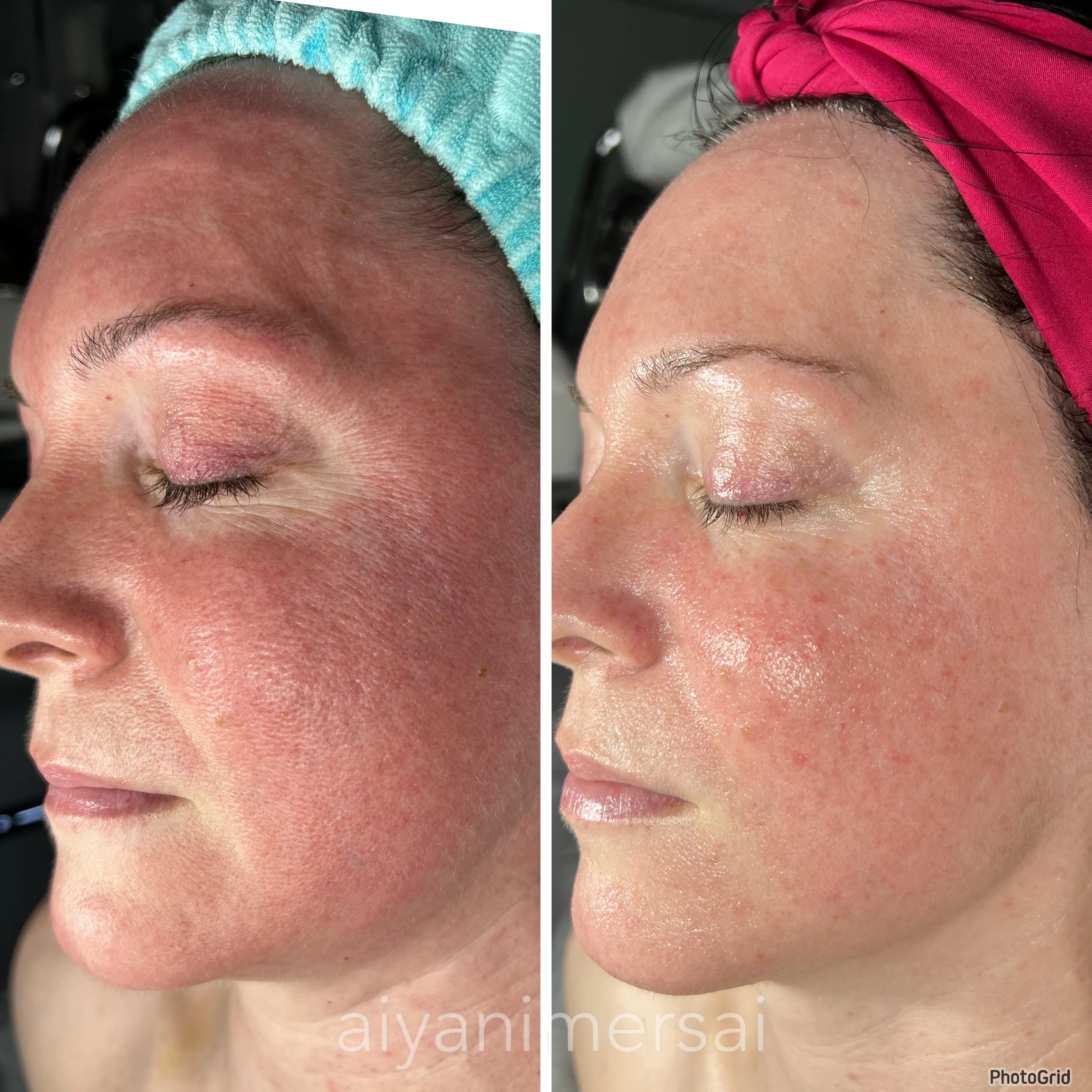 Before and after treatment results