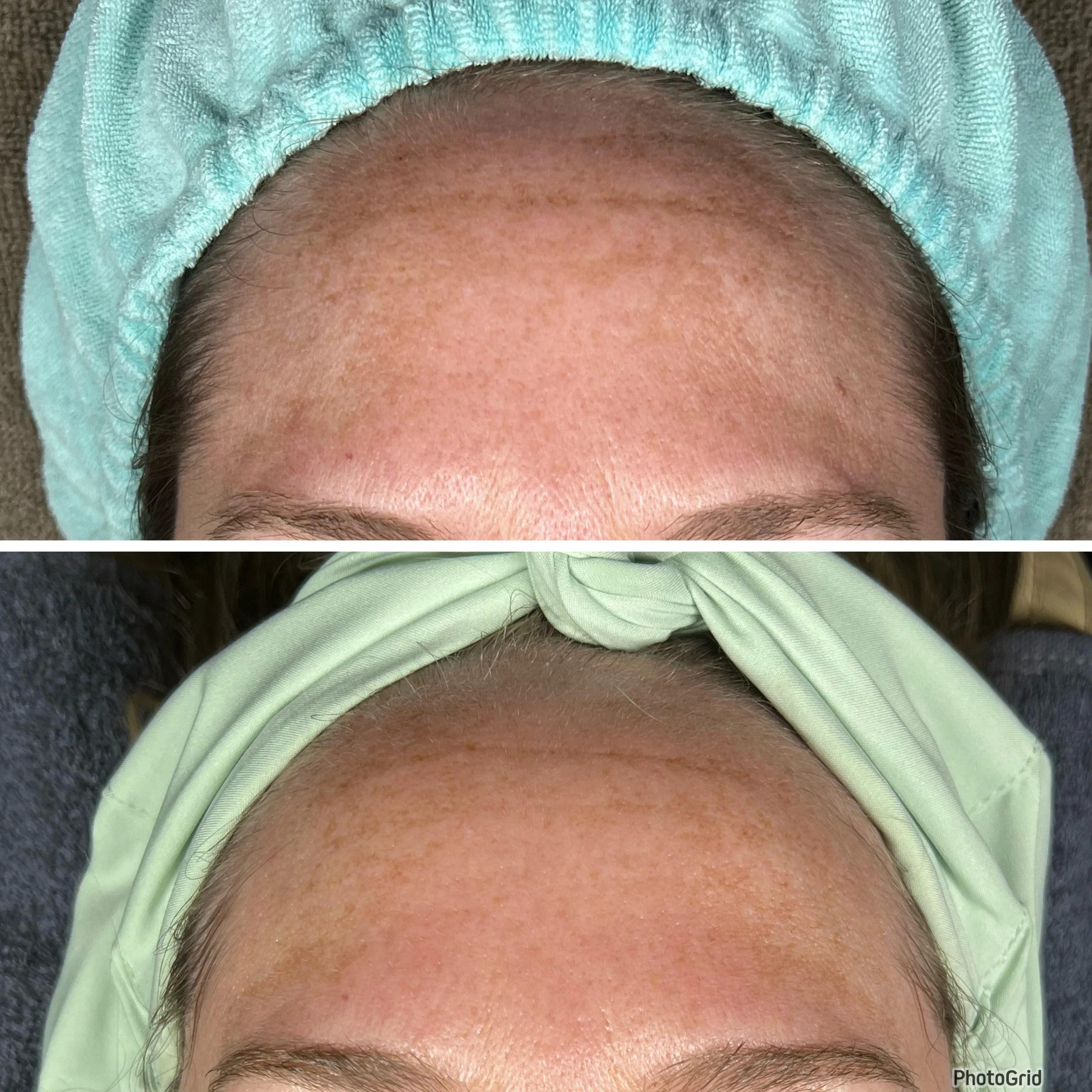 Before and after treatment results