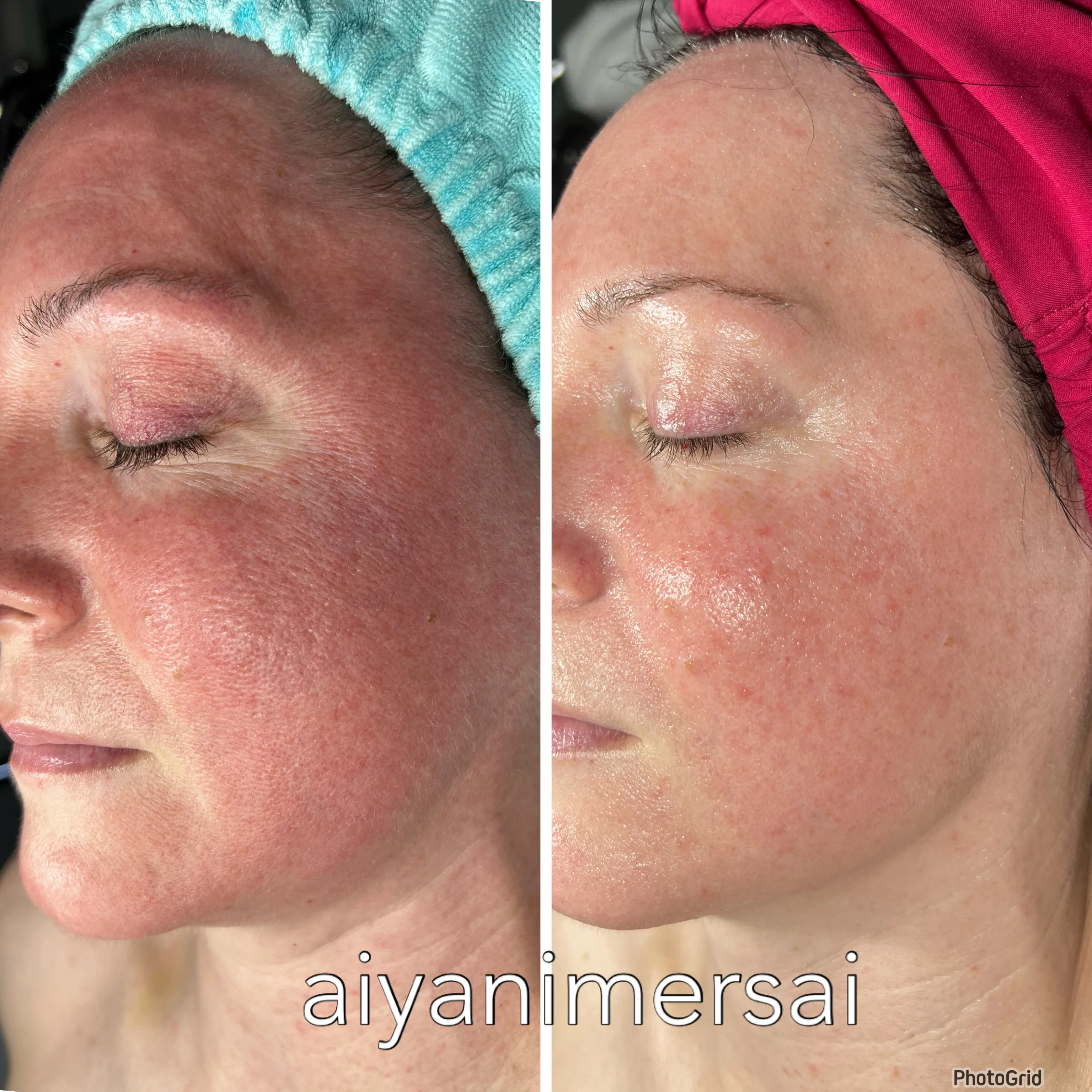 Before and after treatment results