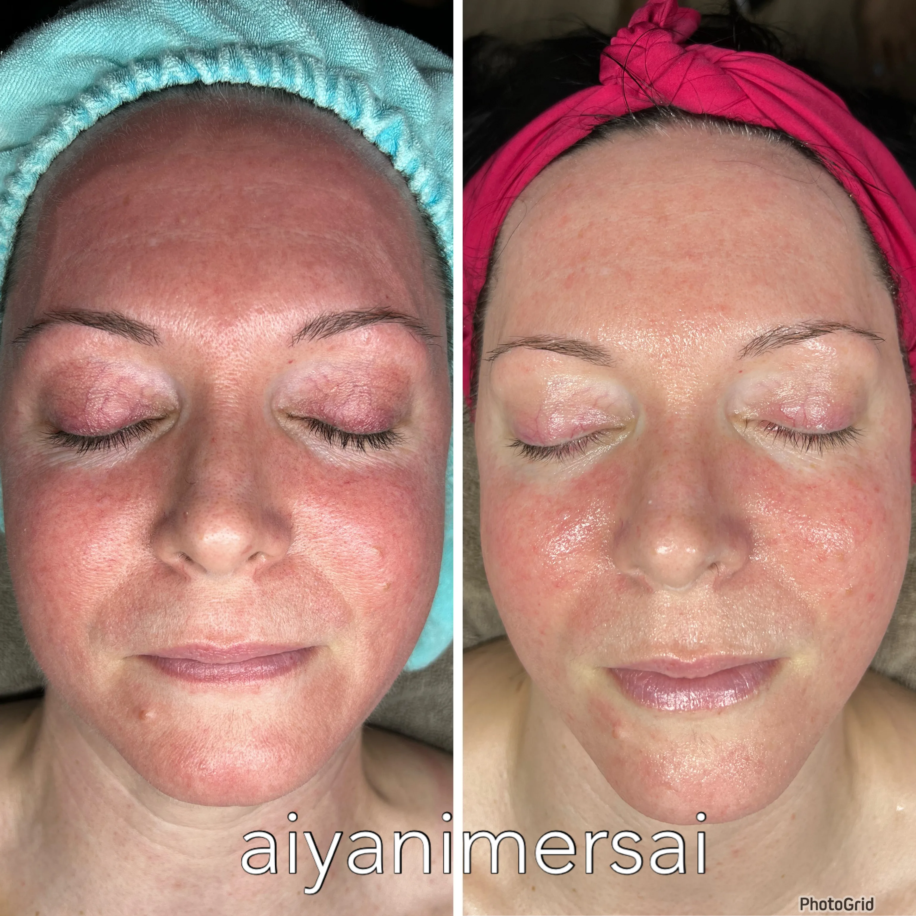 Before and after treatment results