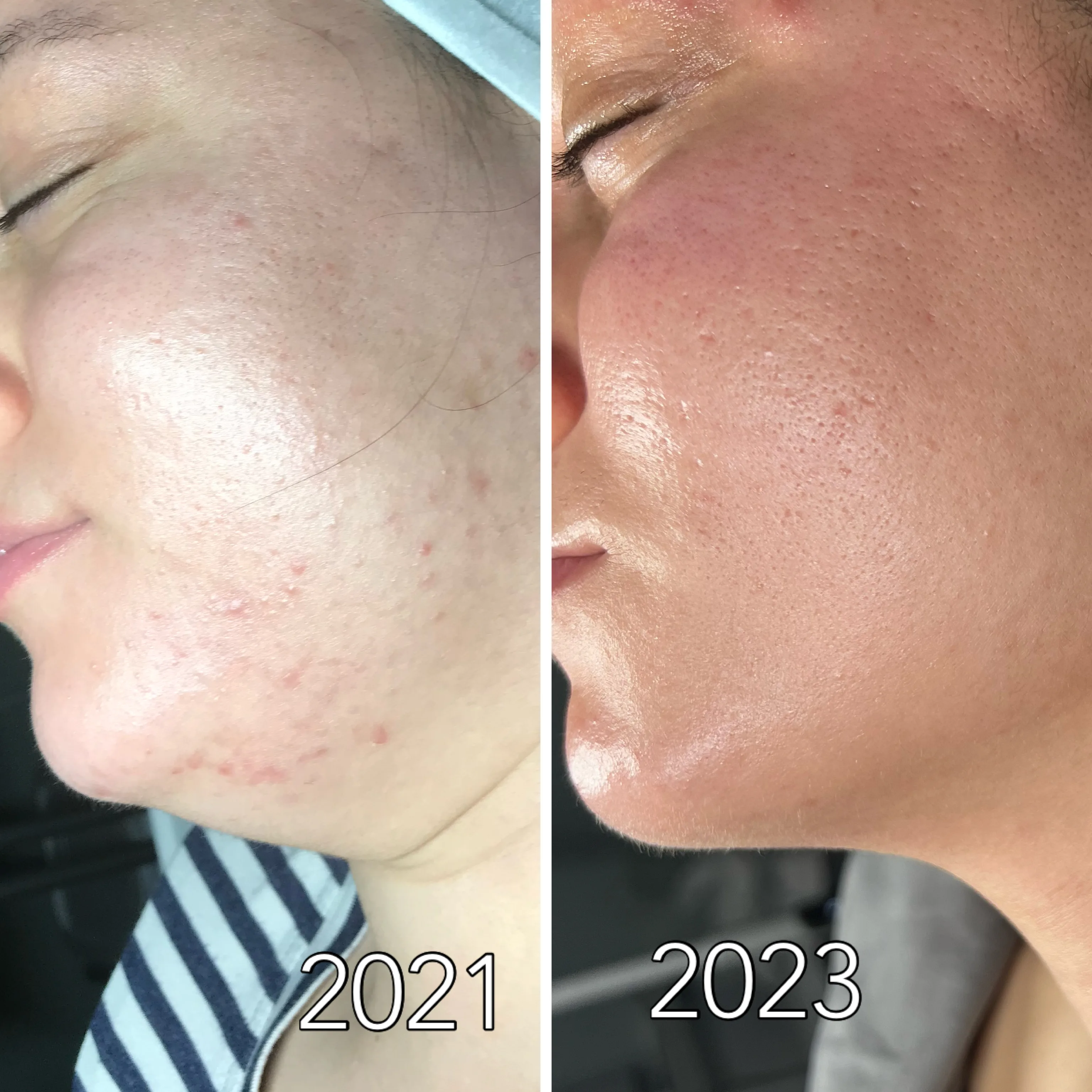 Before and after treatment results