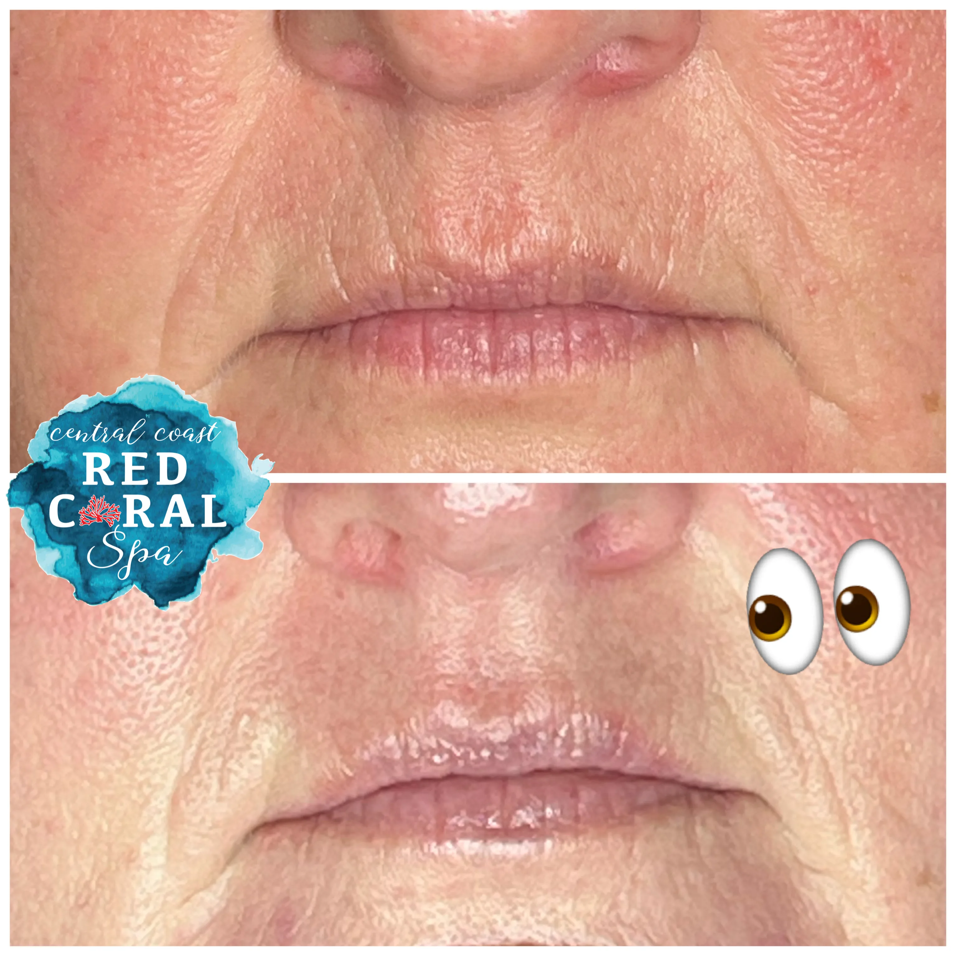 Before and after treatment results