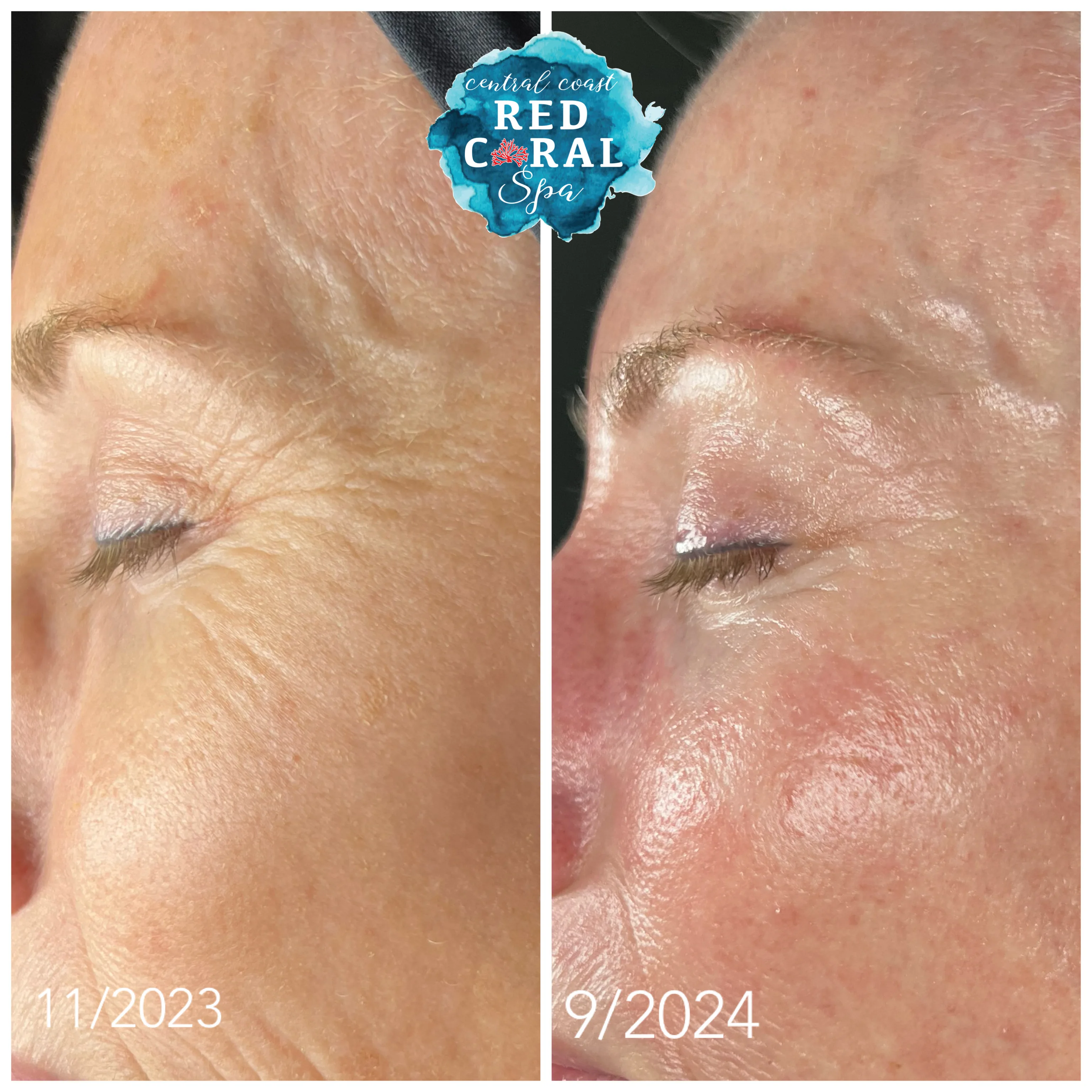 Before and after treatment results