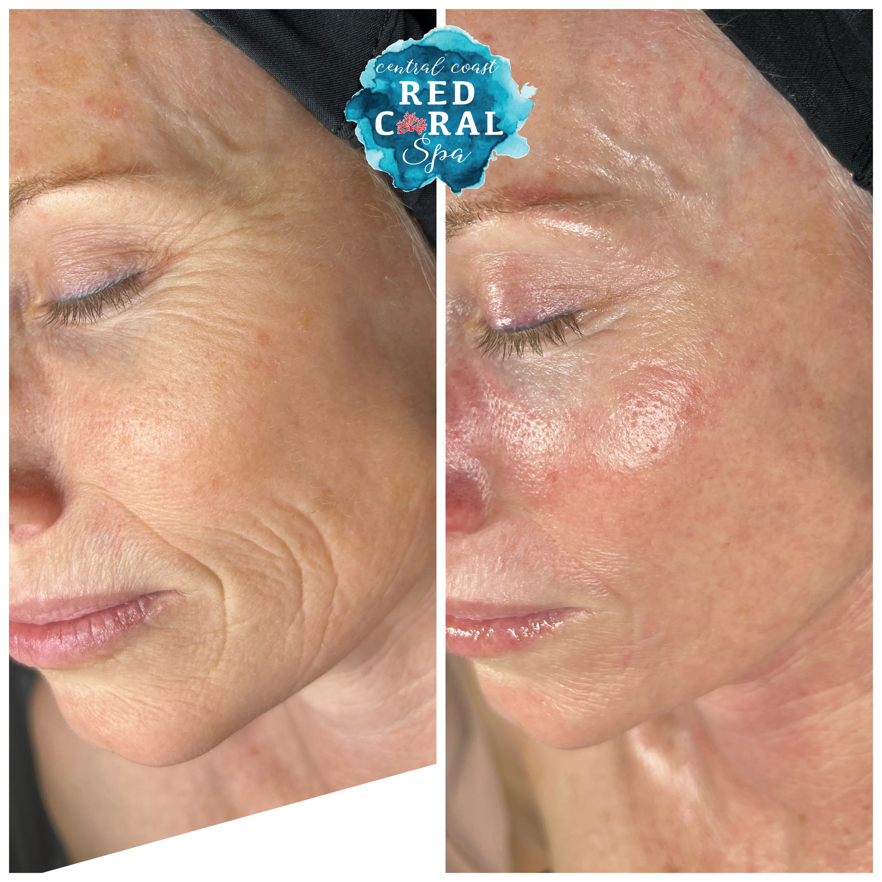 Before and after treatment results