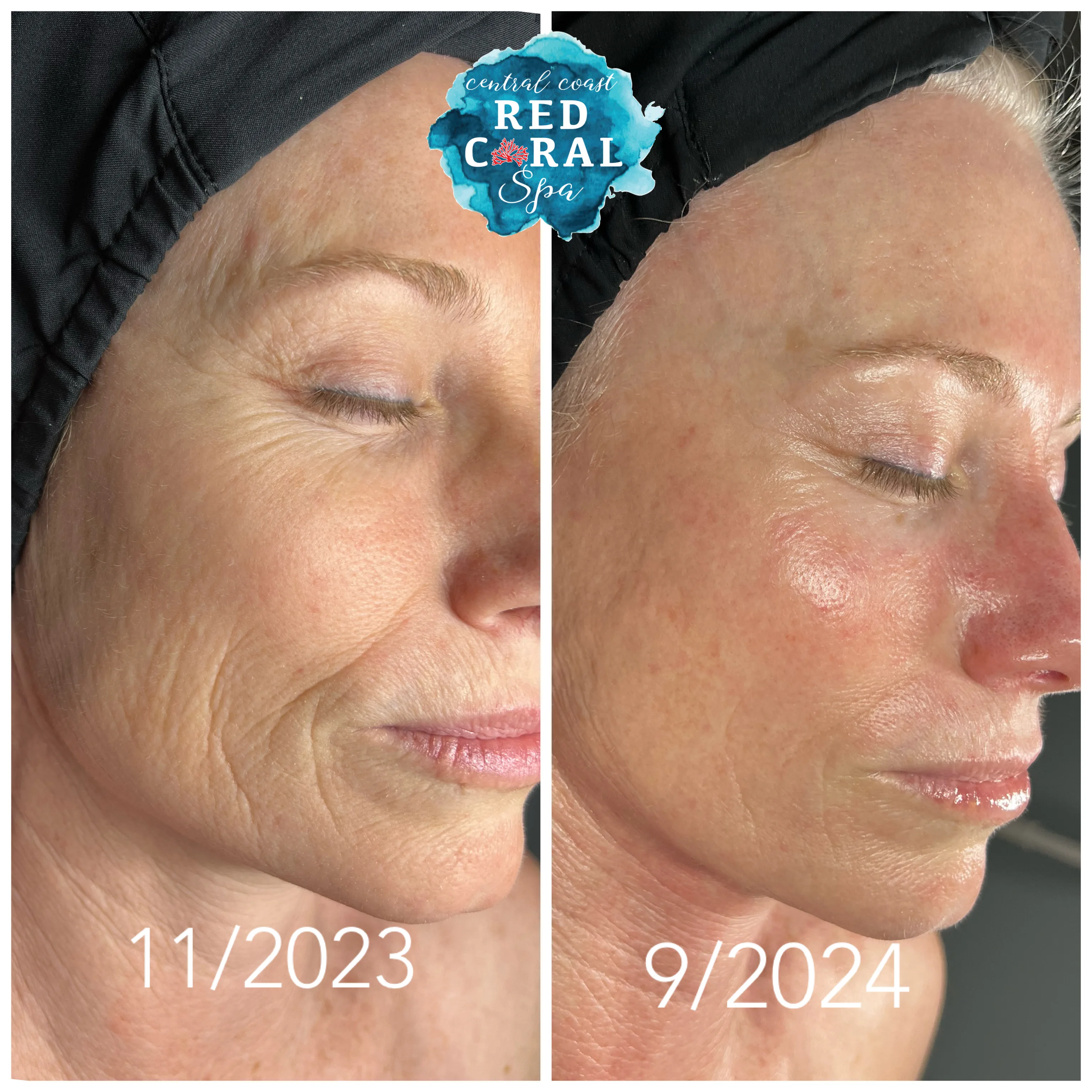 Before and after treatment results