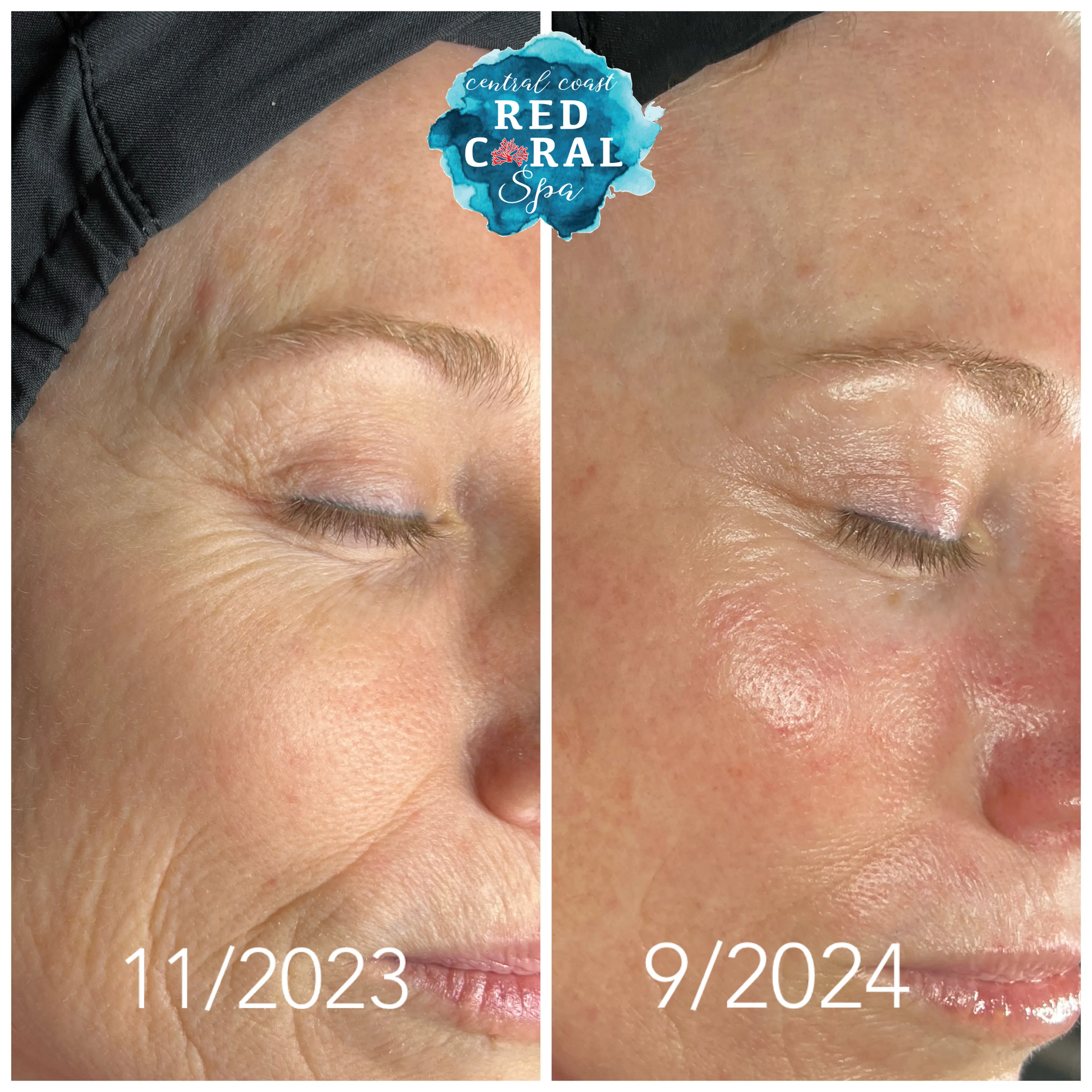 Jenny S. — before and after results