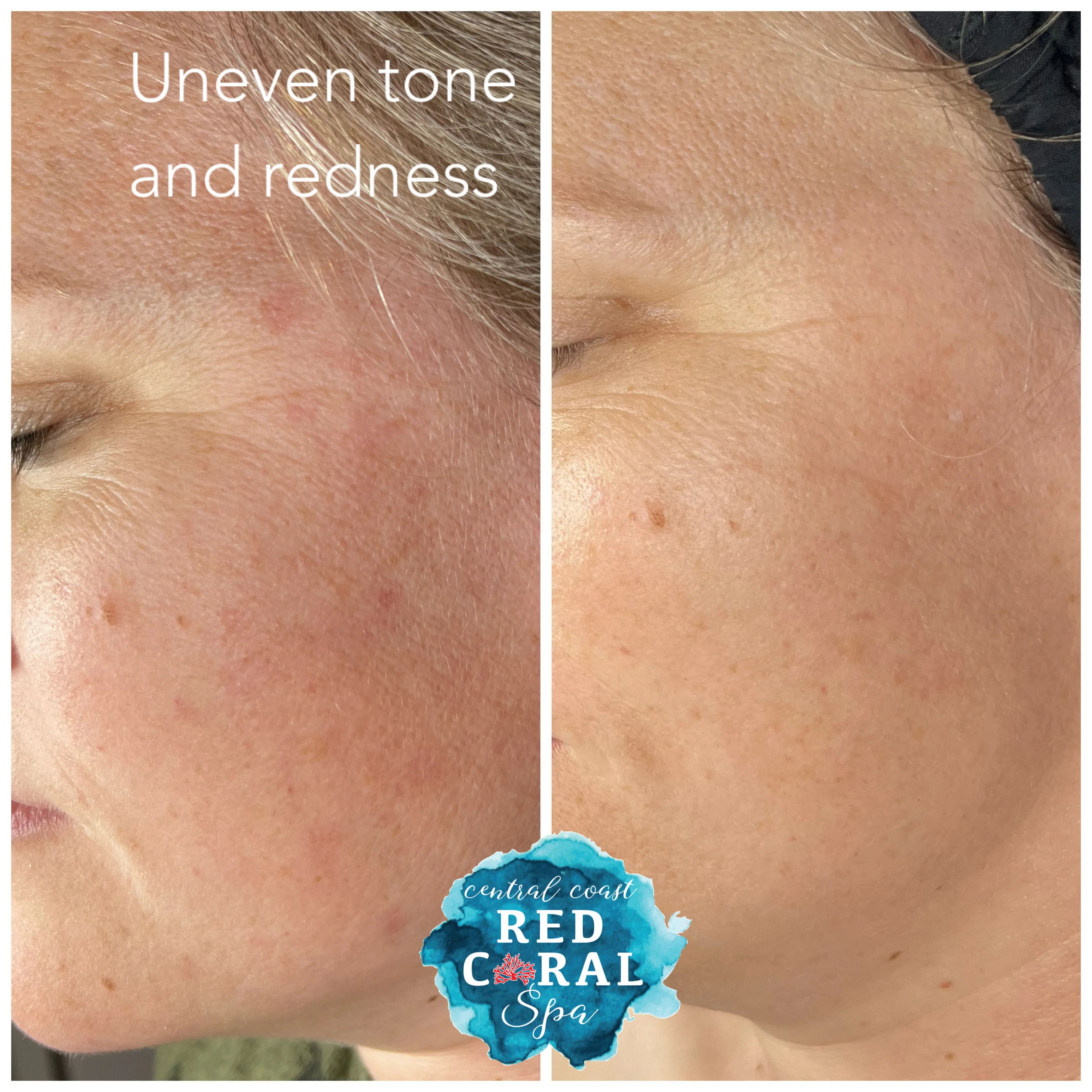 Before and after treatment results