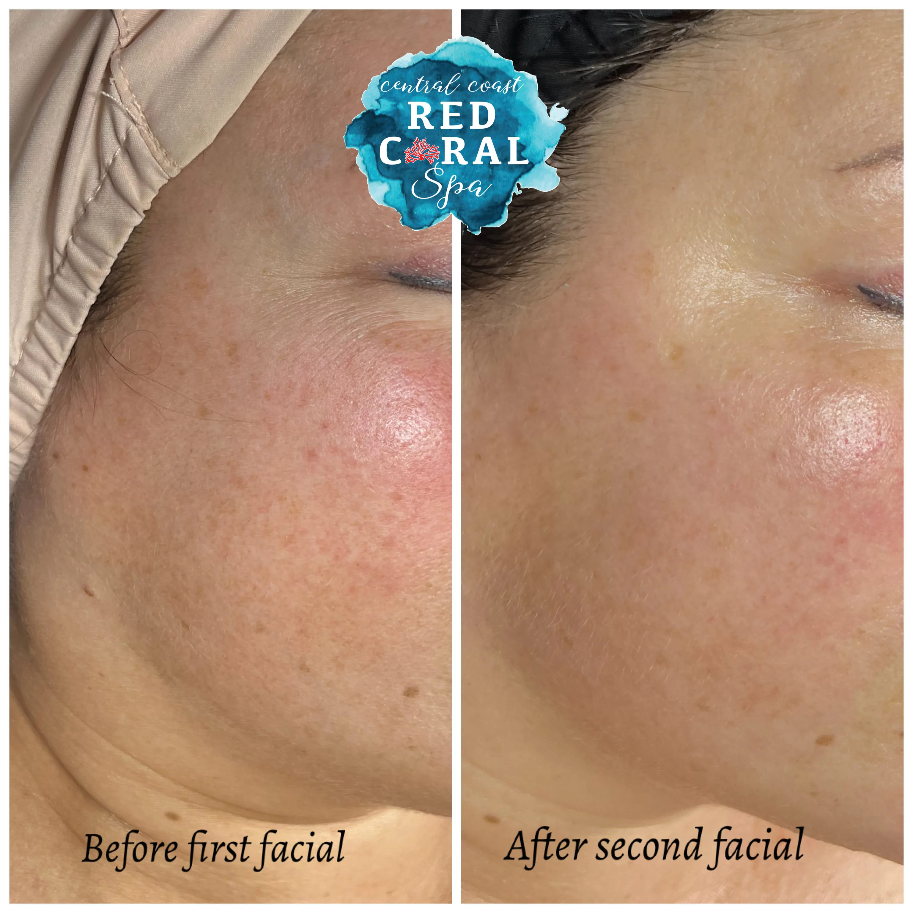 Before and after treatment results