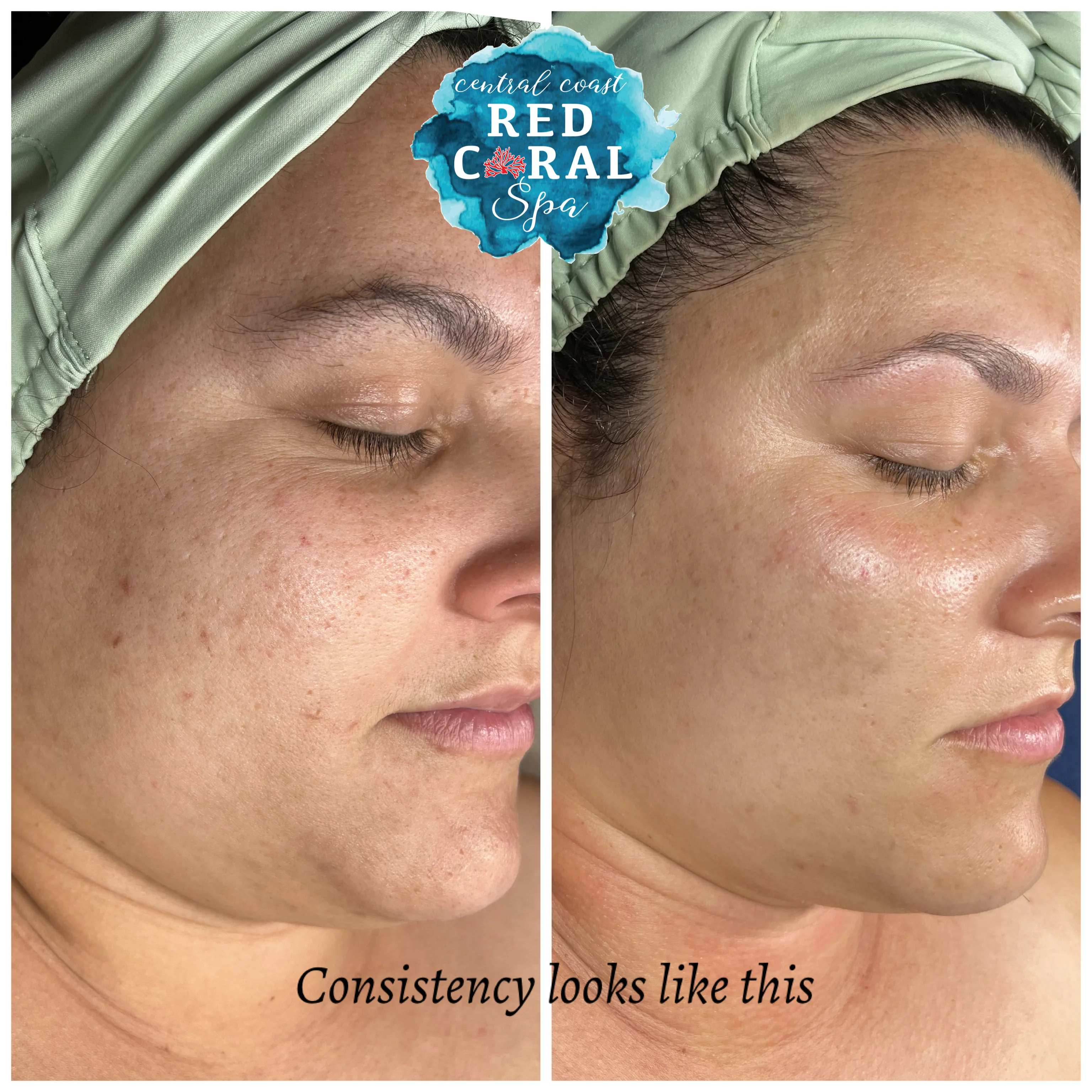 Before and after treatment results