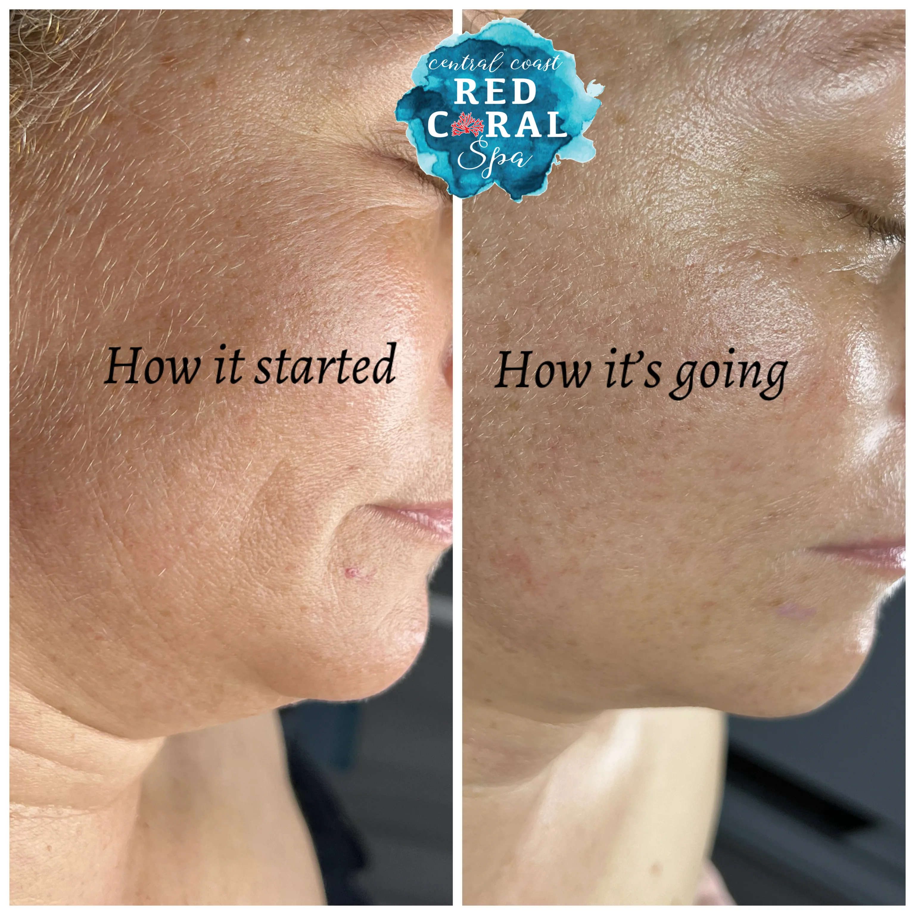 Before and after treatment results