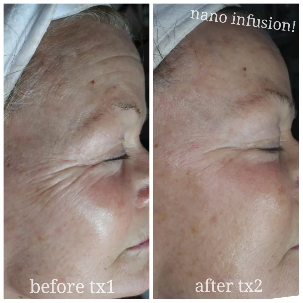 Before and after treatment results