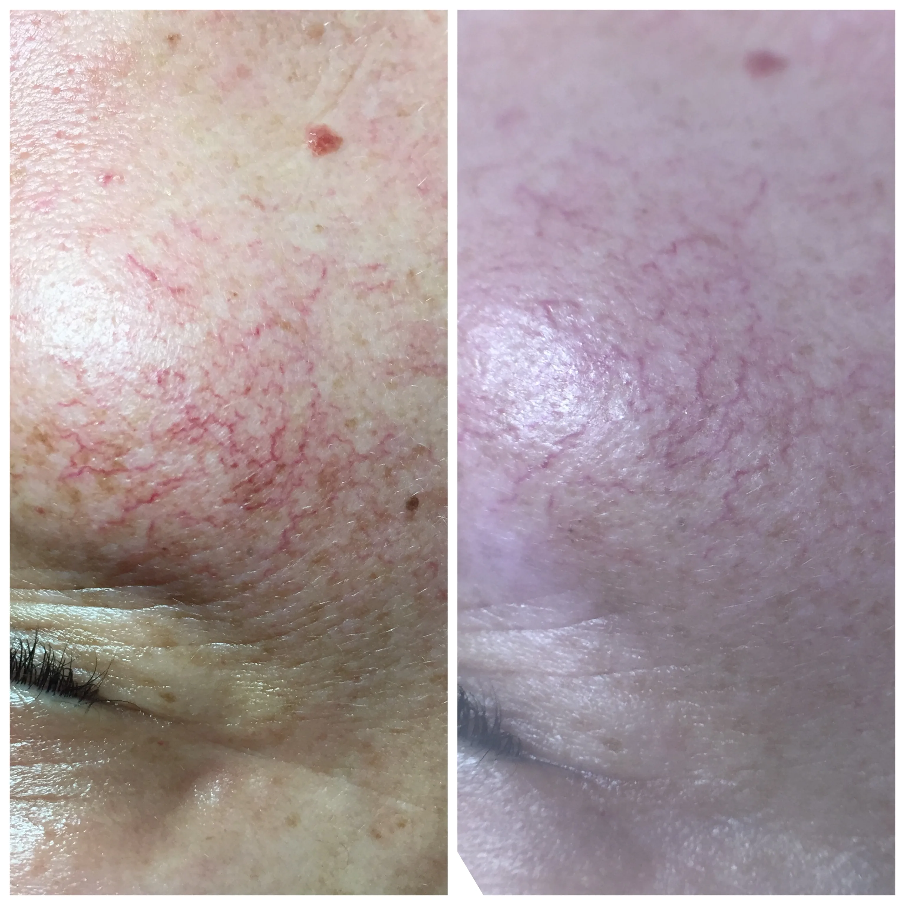 Before and after treatment results