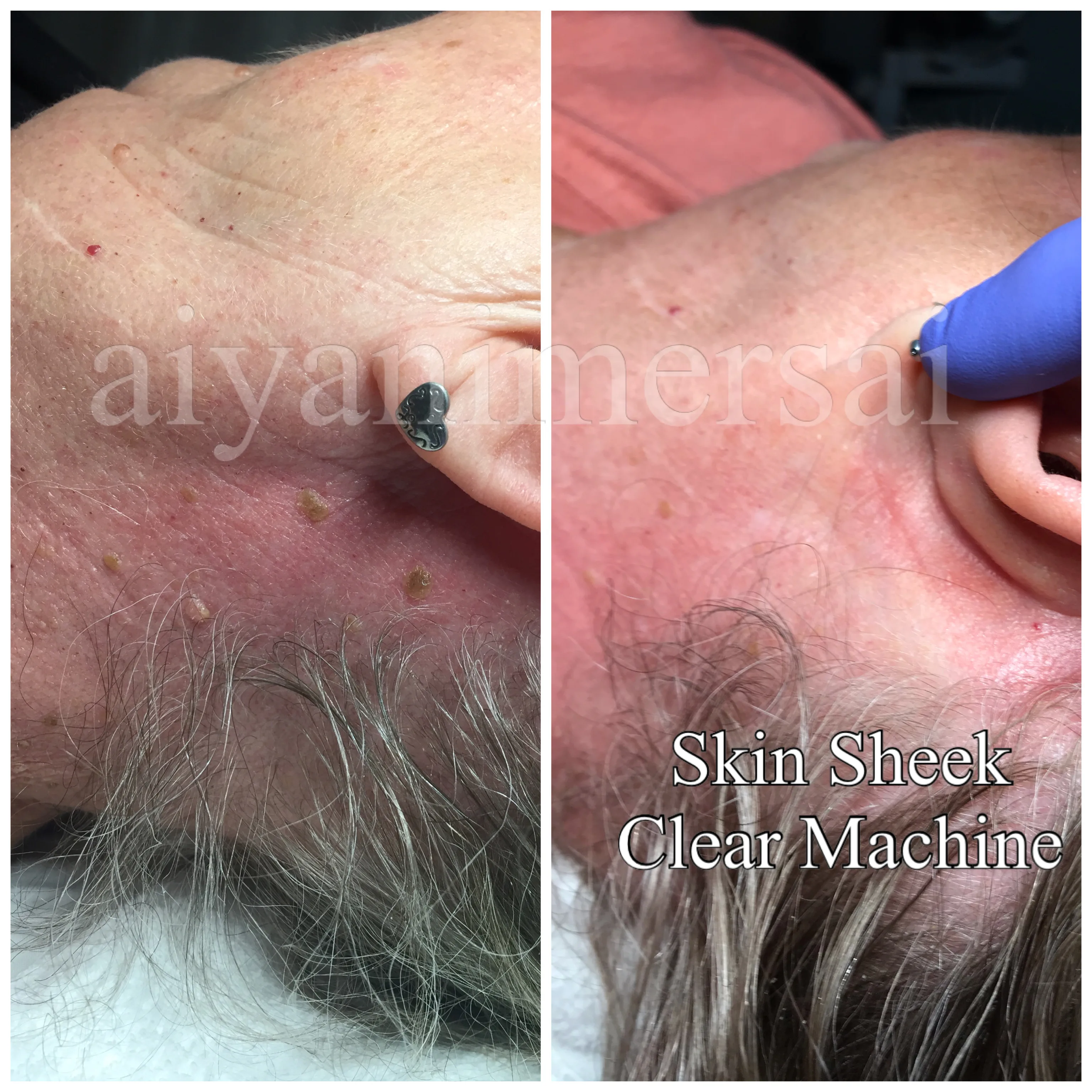 Before and after treatment results