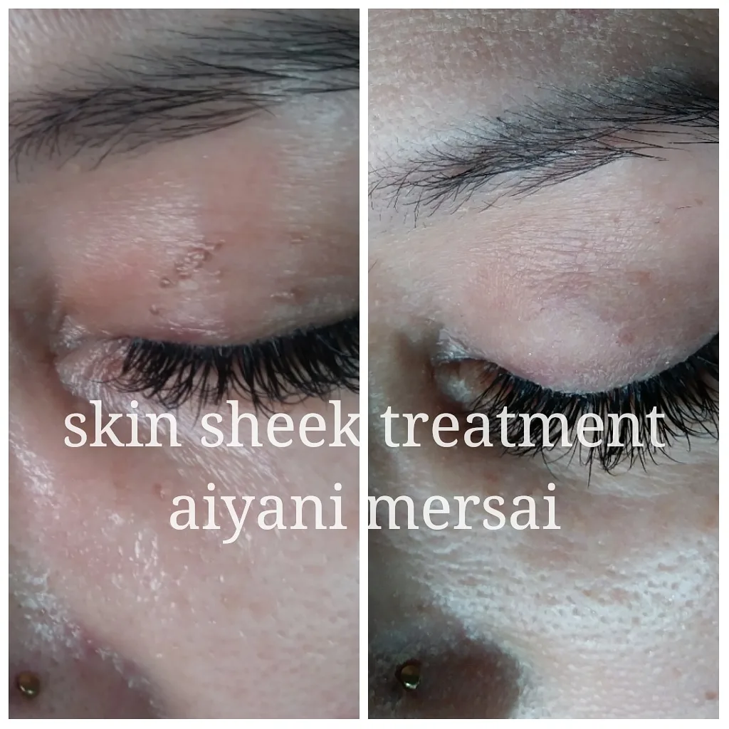 Before and after treatment results