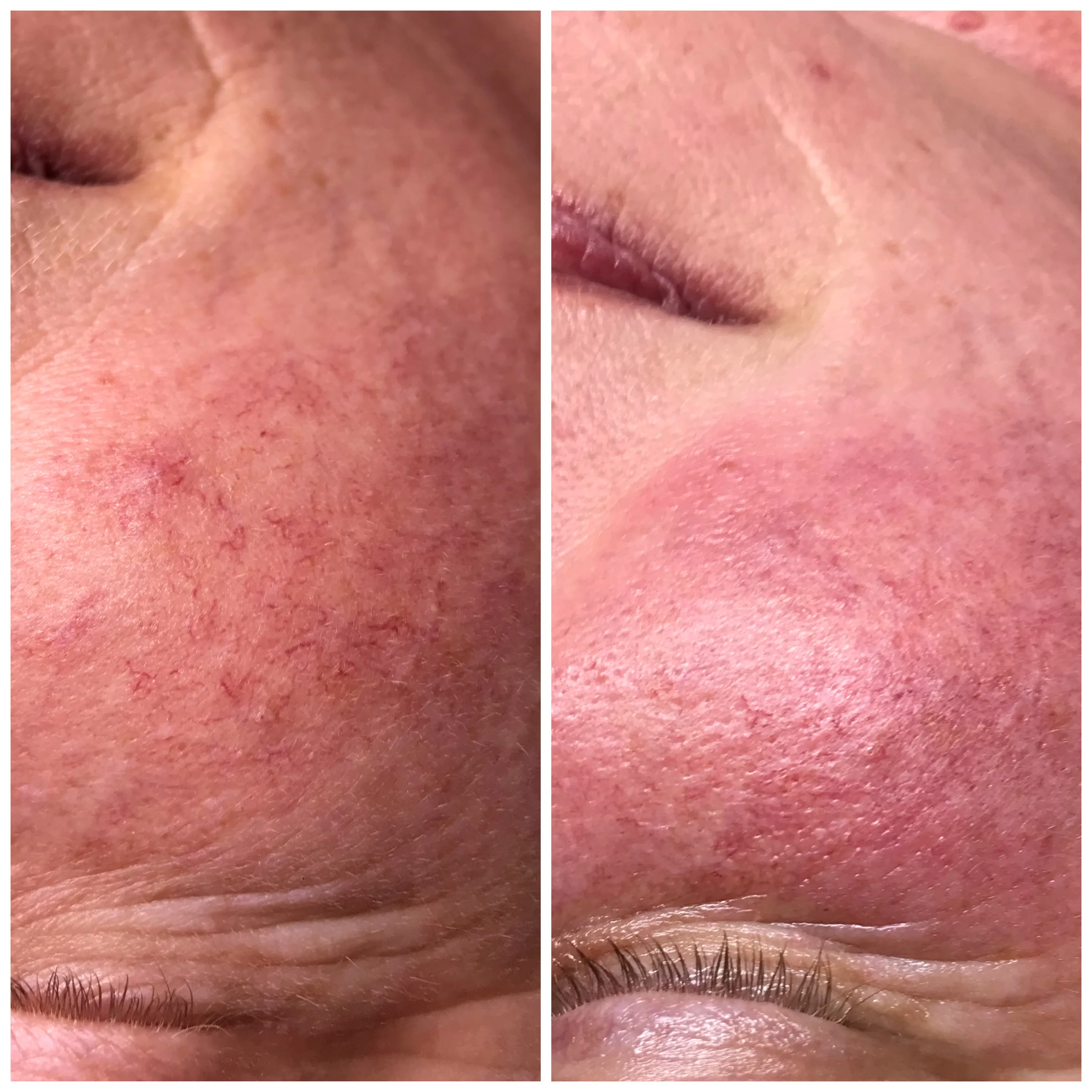 Before and after treatment results
