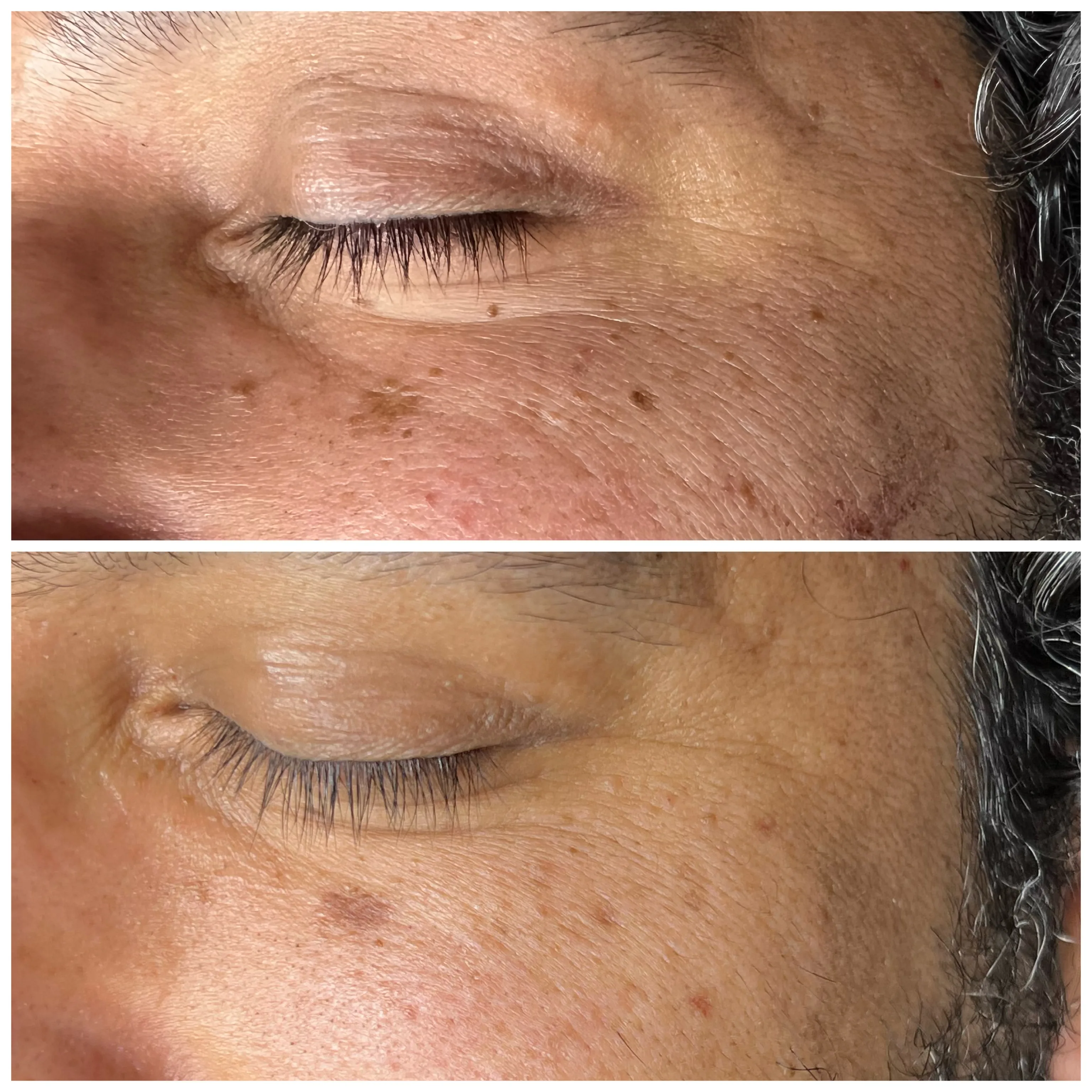 Before and after treatment results