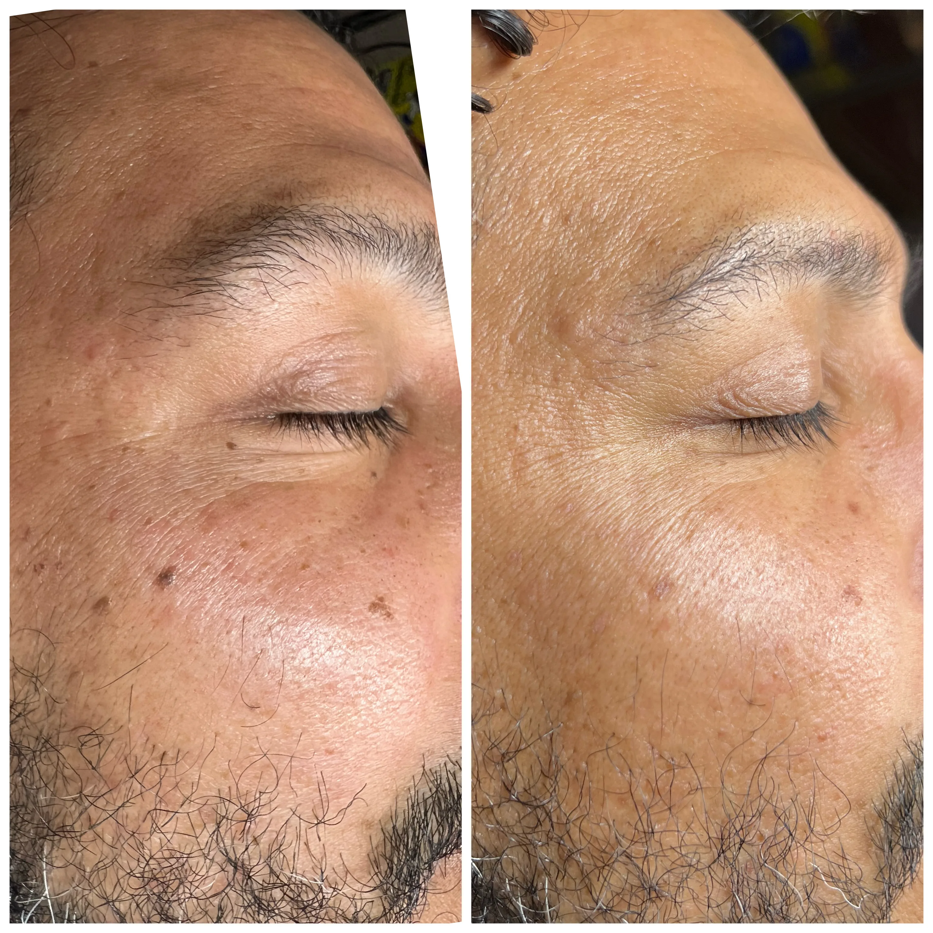 Before and after treatment results
