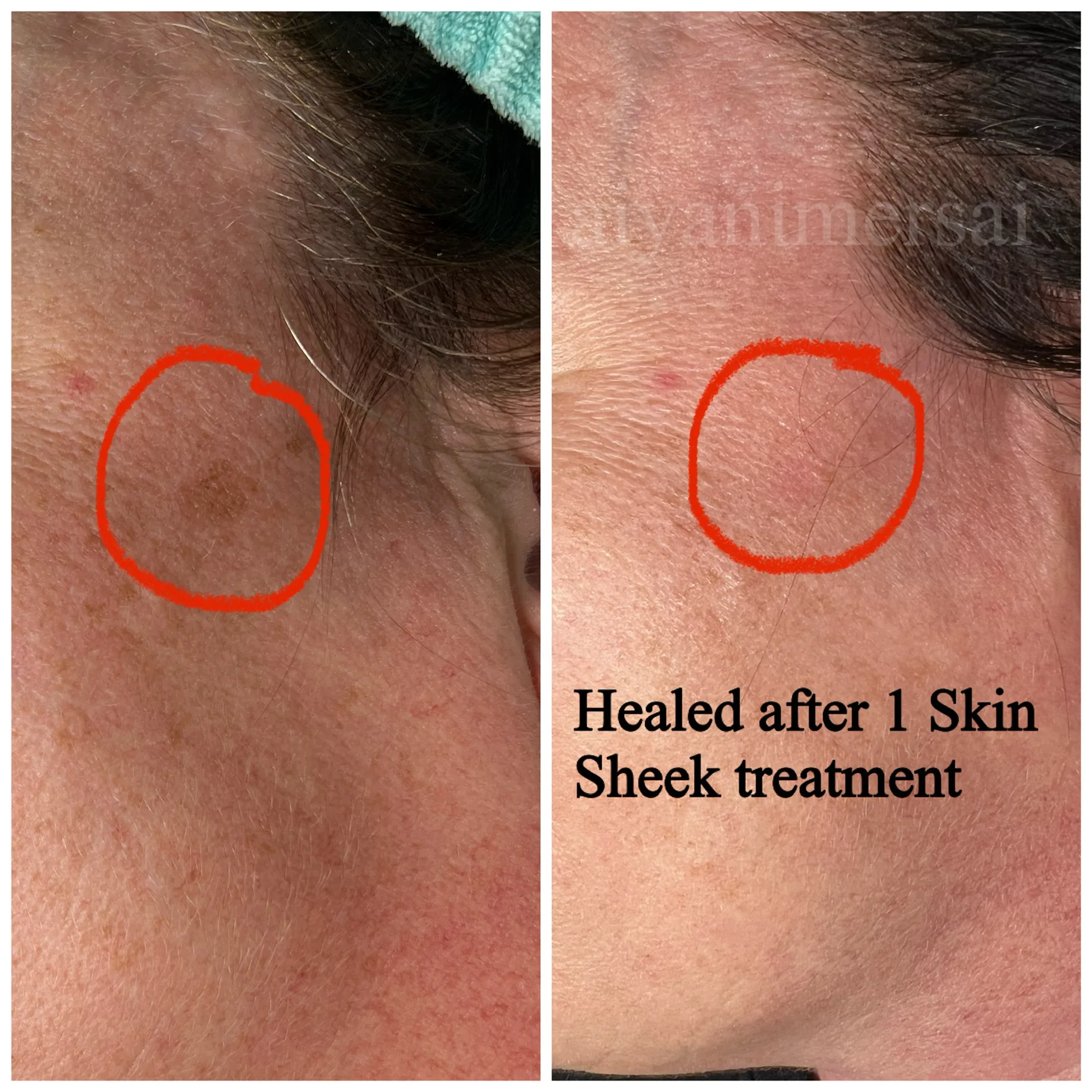 Before and after treatment results