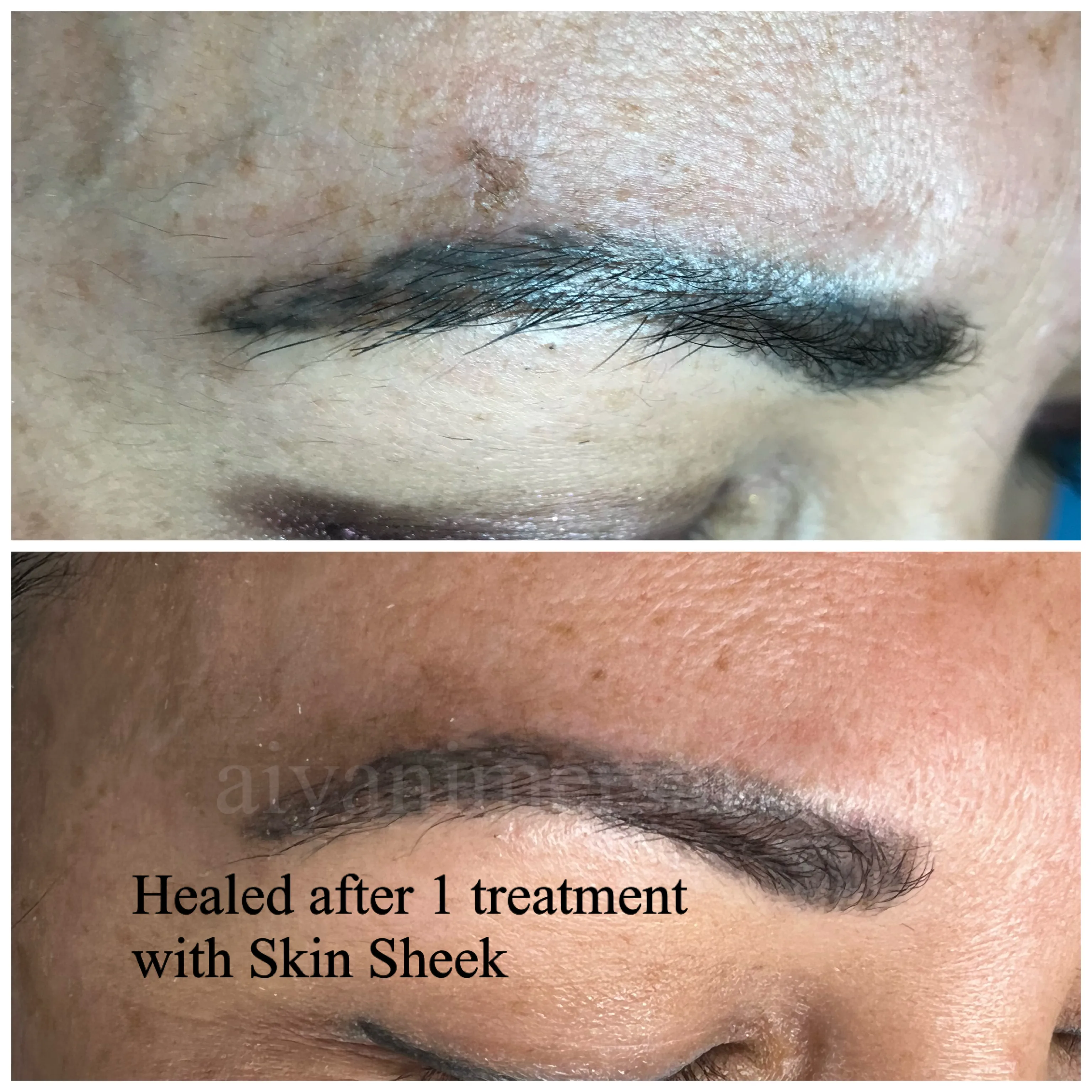 Before and after treatment results