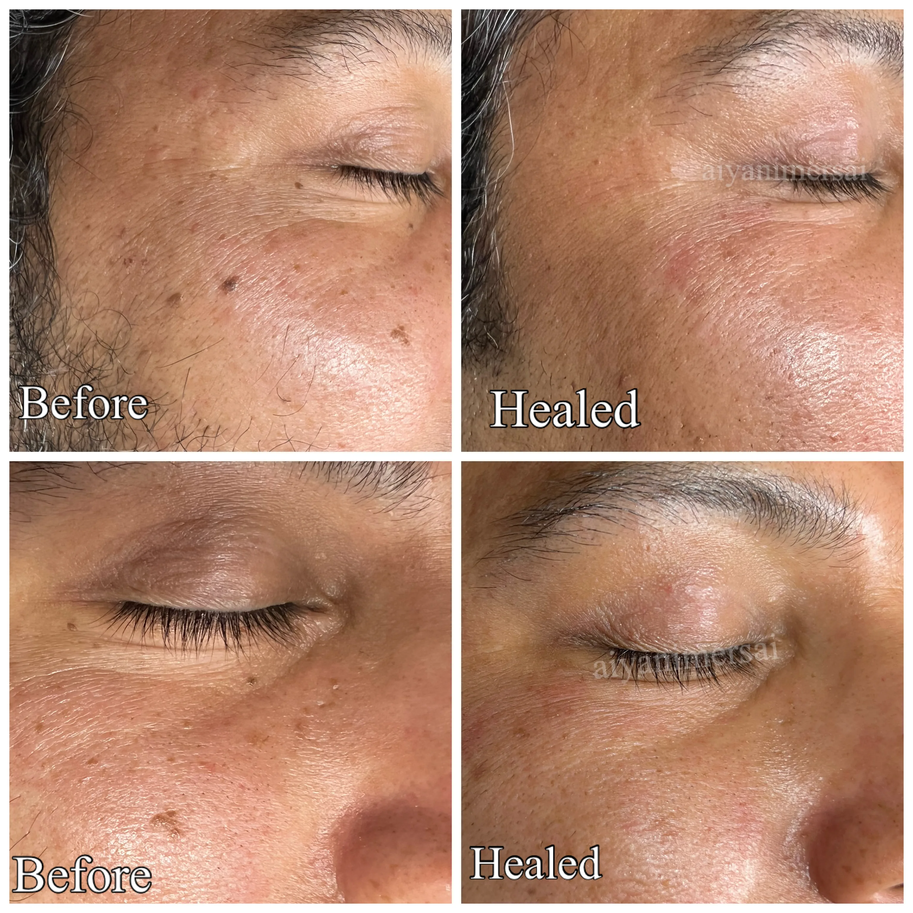Before and after treatment results