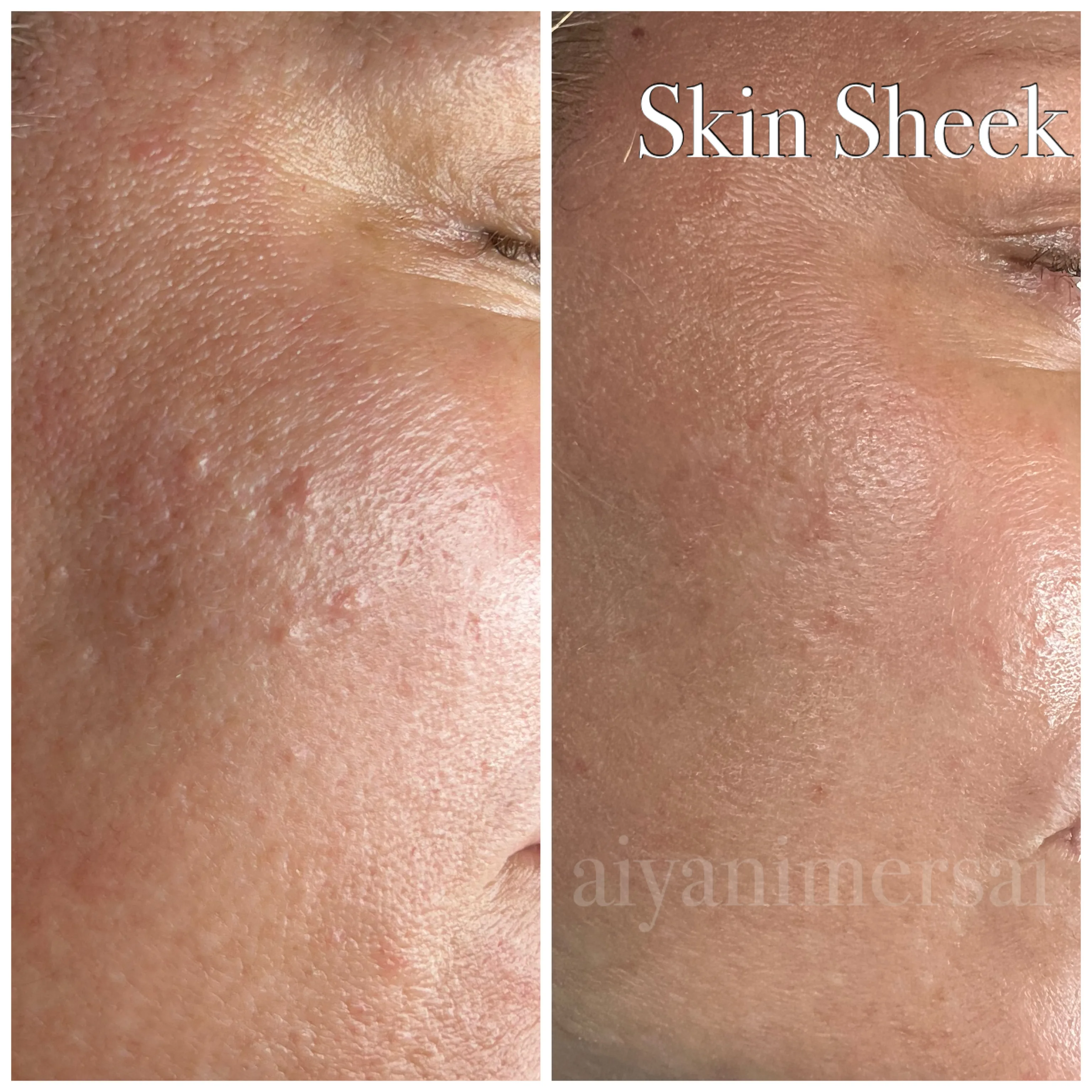 Before and after treatment results