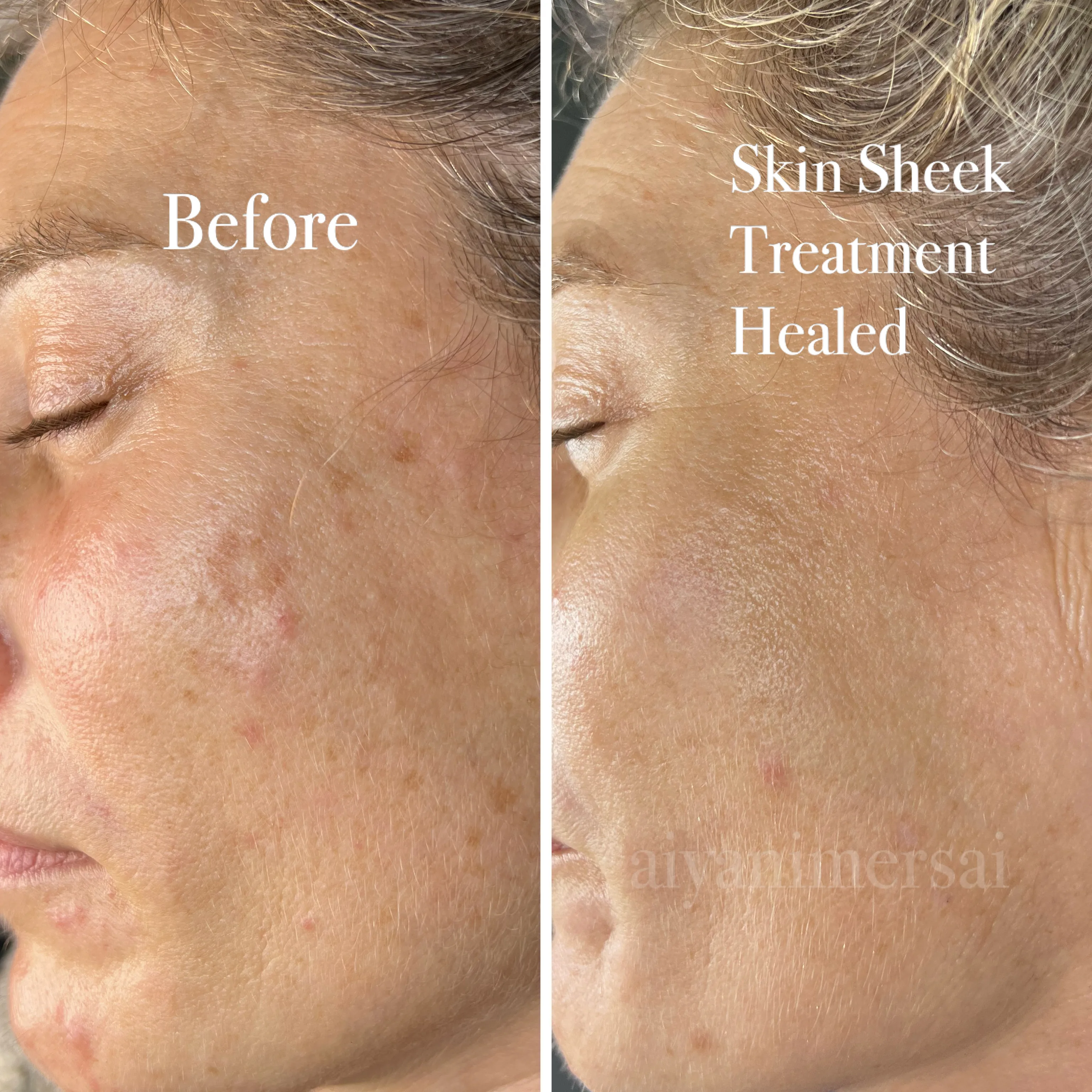 Before and after treatment results