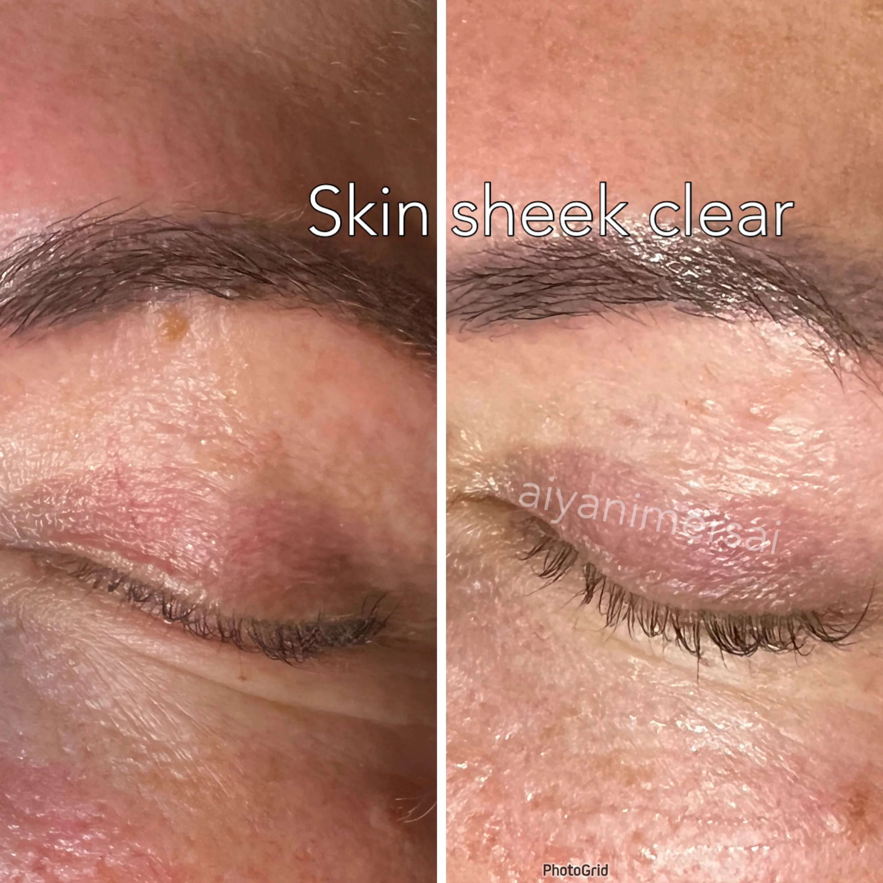 Before and after treatment results