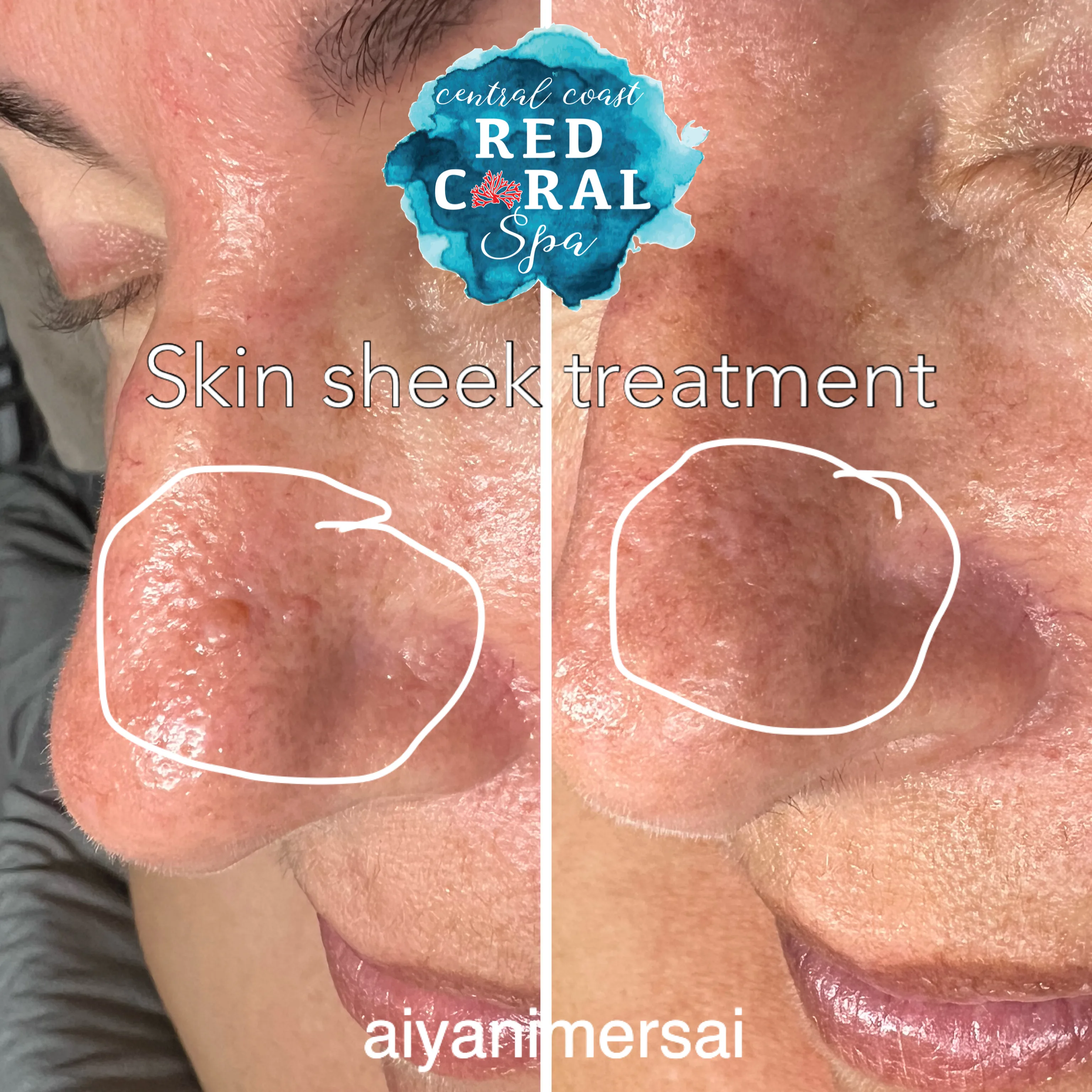 Before and after treatment results