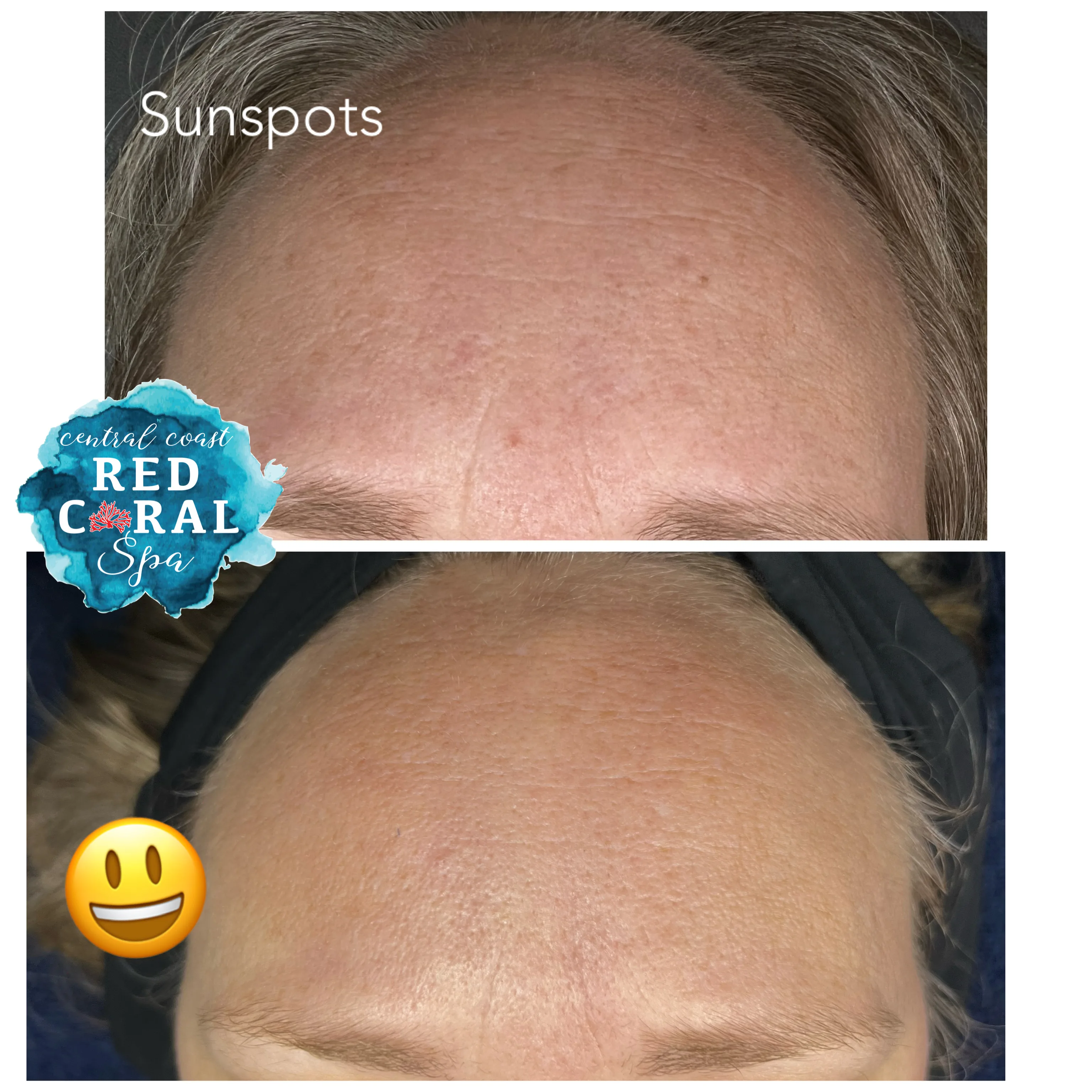 Before and after treatment results