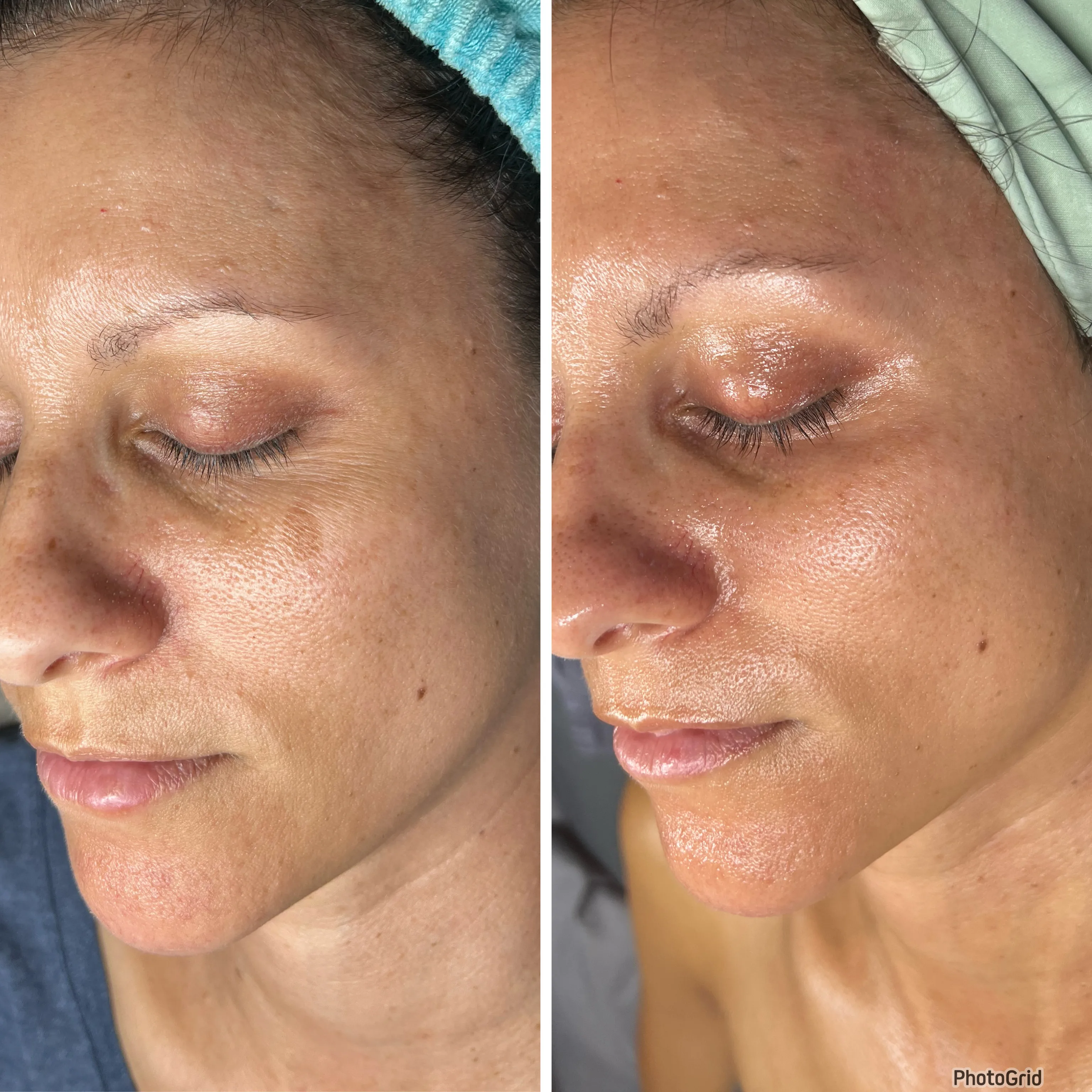 Before and after treatment results