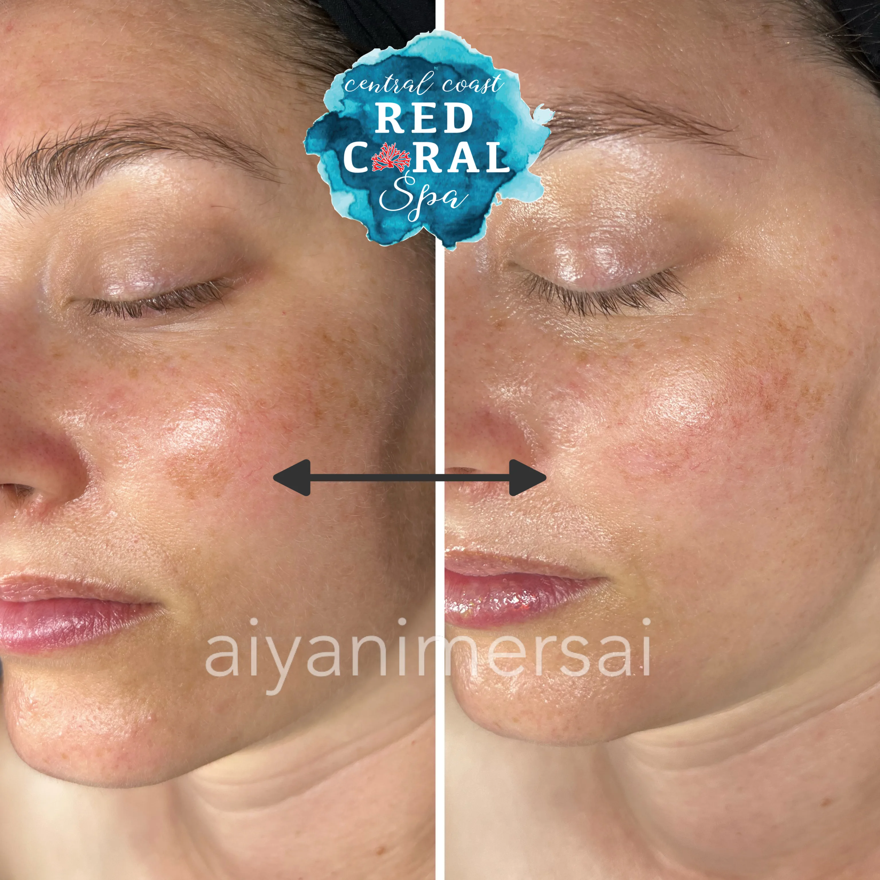 Before and after treatment results