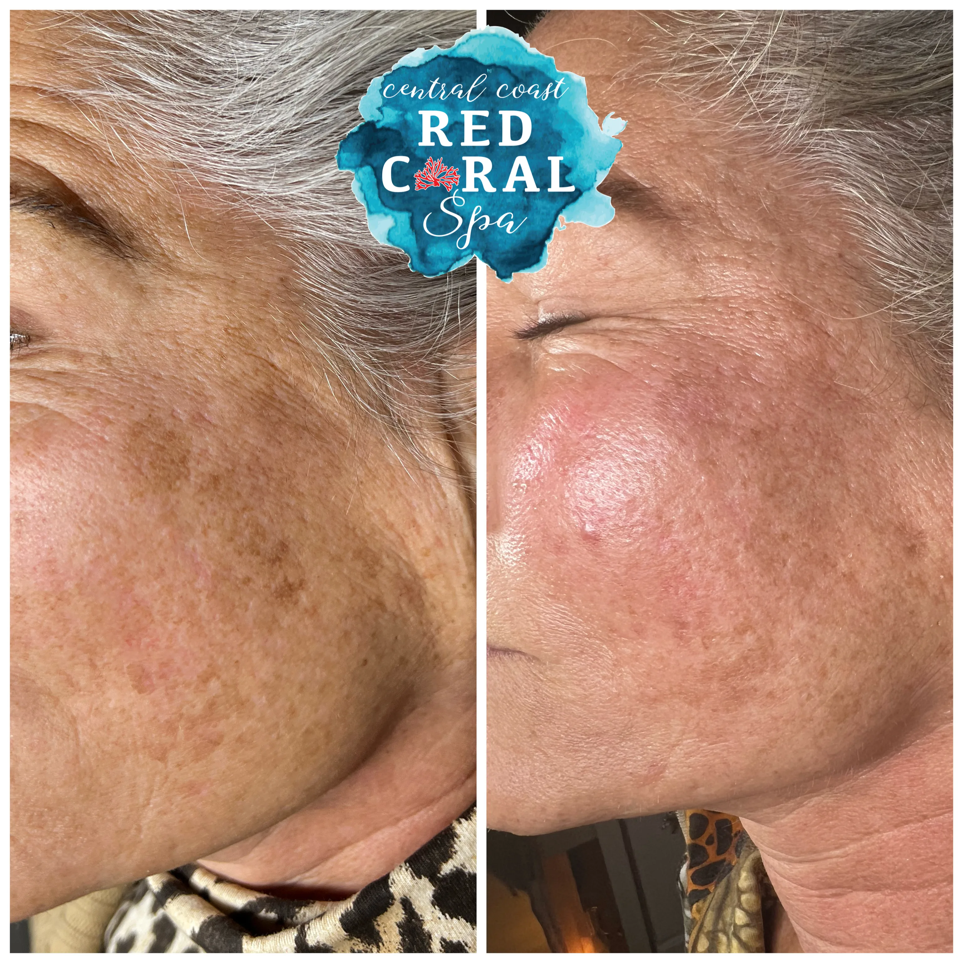 Before and after treatment results