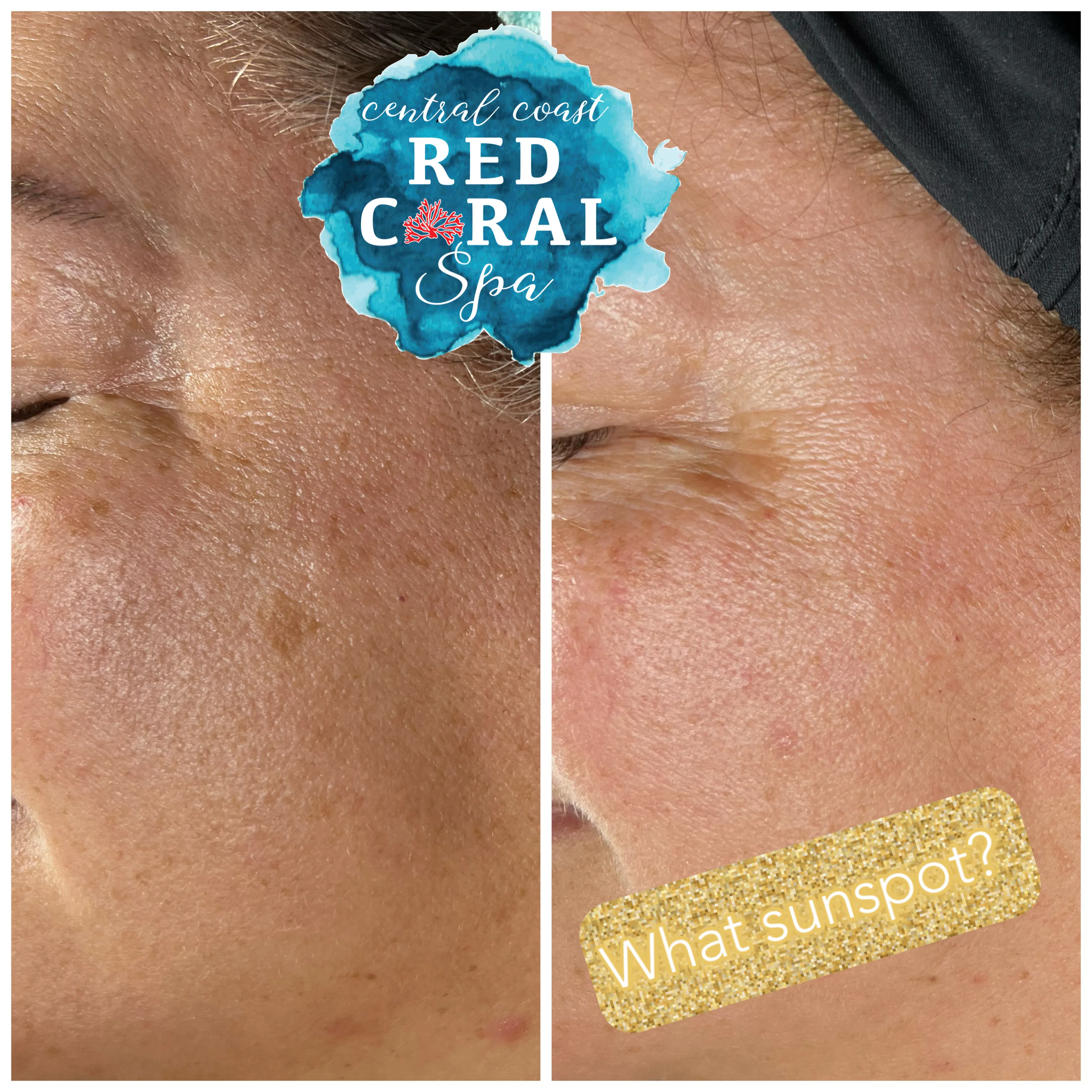 Before and after treatment results