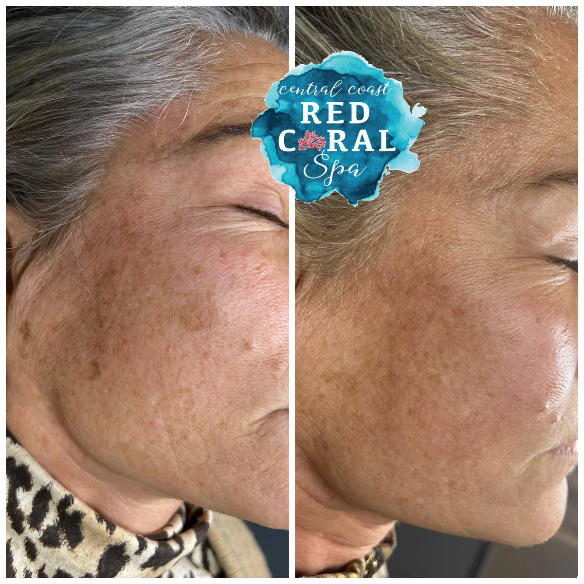 Before and after treatment results