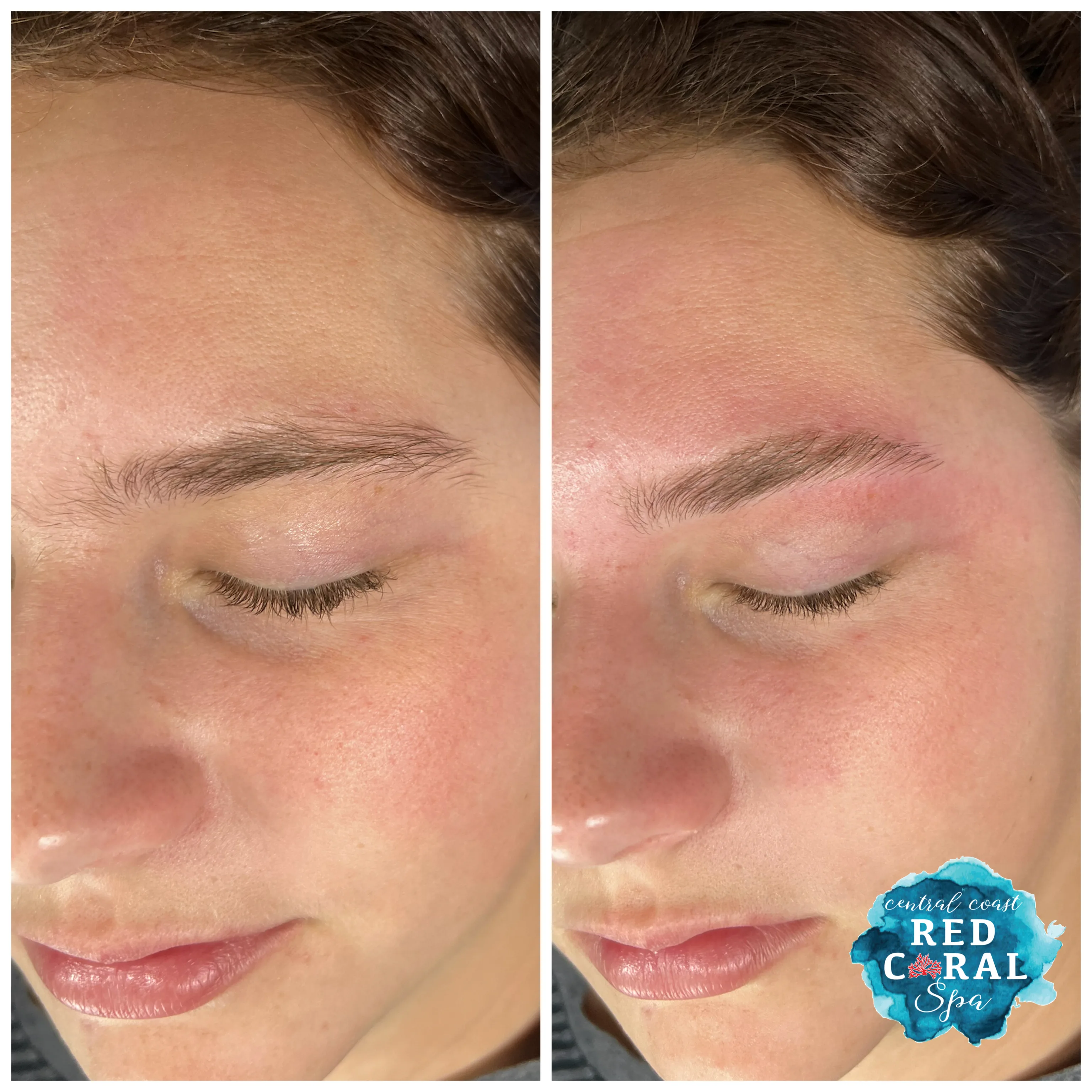 Before and after treatment results