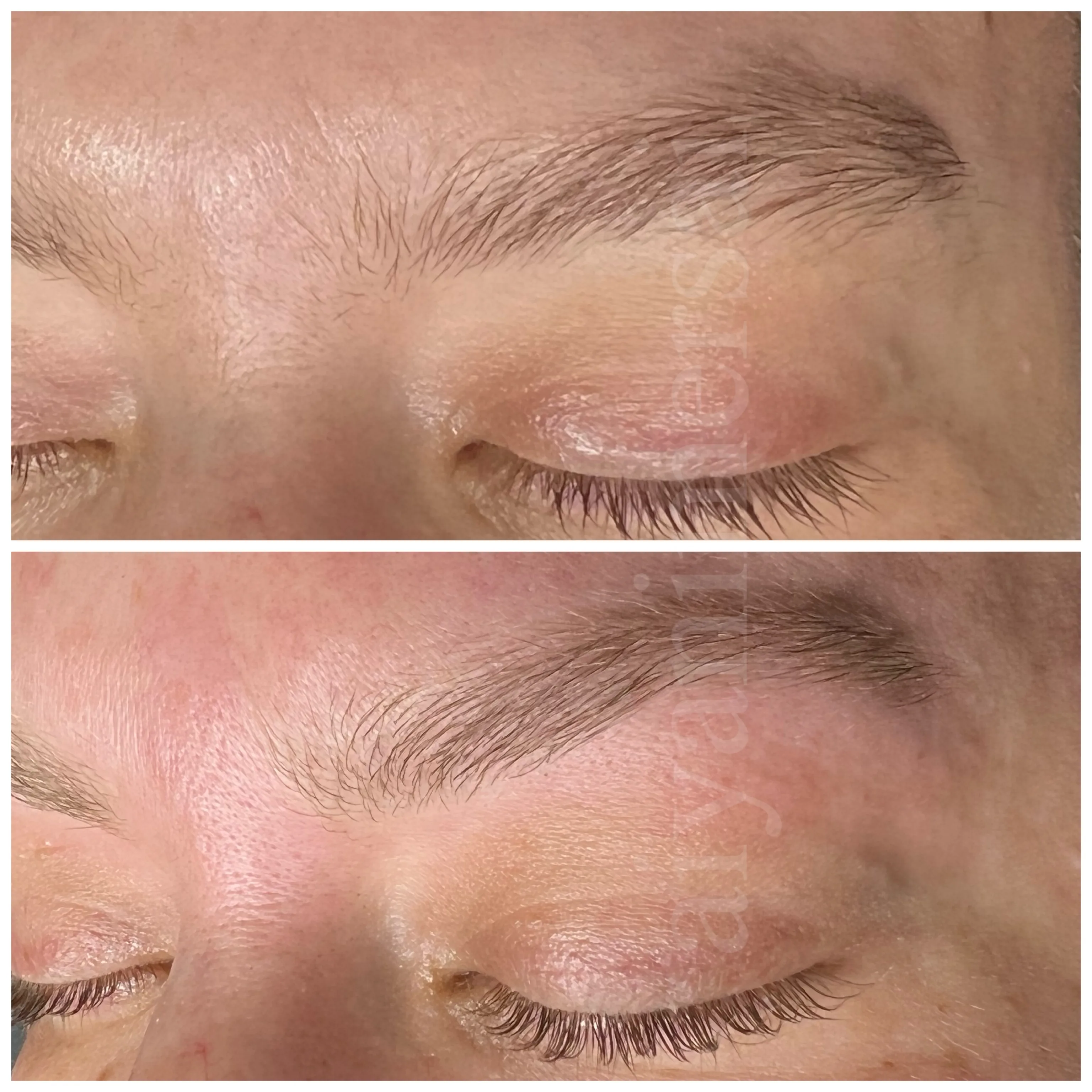 Before and after treatment results