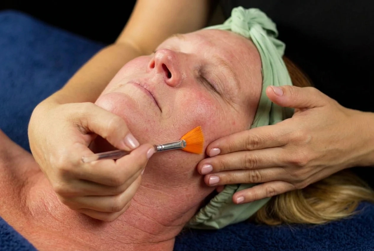 Advanced Dermodality peel treatment at Red Coral Spa