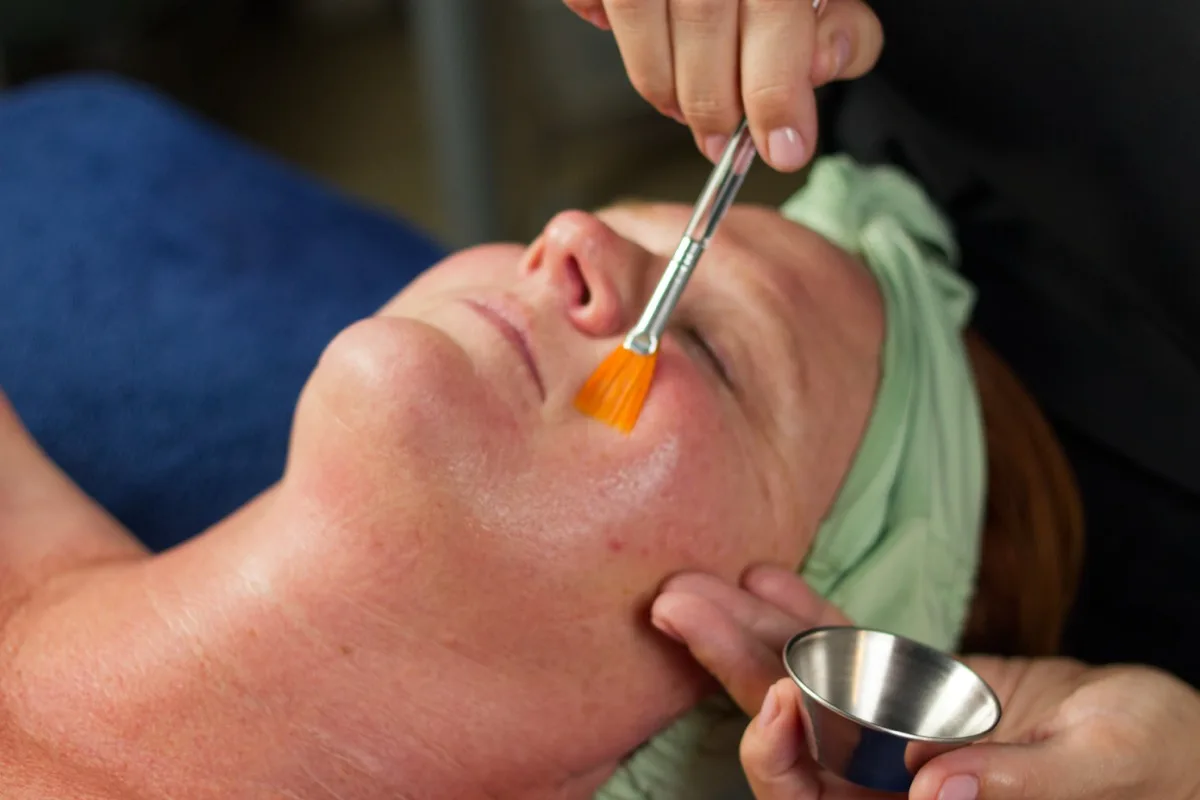Starter chemical peel application at Central Coast Red Coral Spa